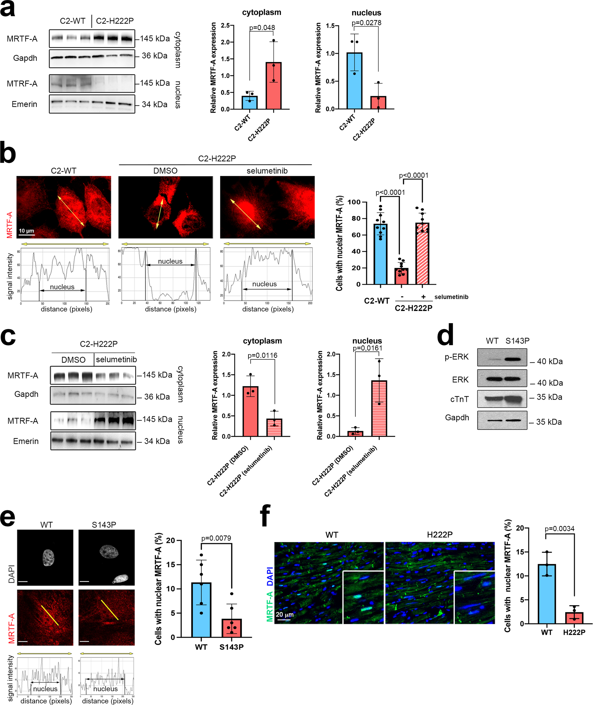 Actin Microtubule Cytoskeletal Interplay Mediated By Mrtf A Srf Signaling Promotes Dilated Cardiomyopathy Caused By Lmna Mutations Nature Communications