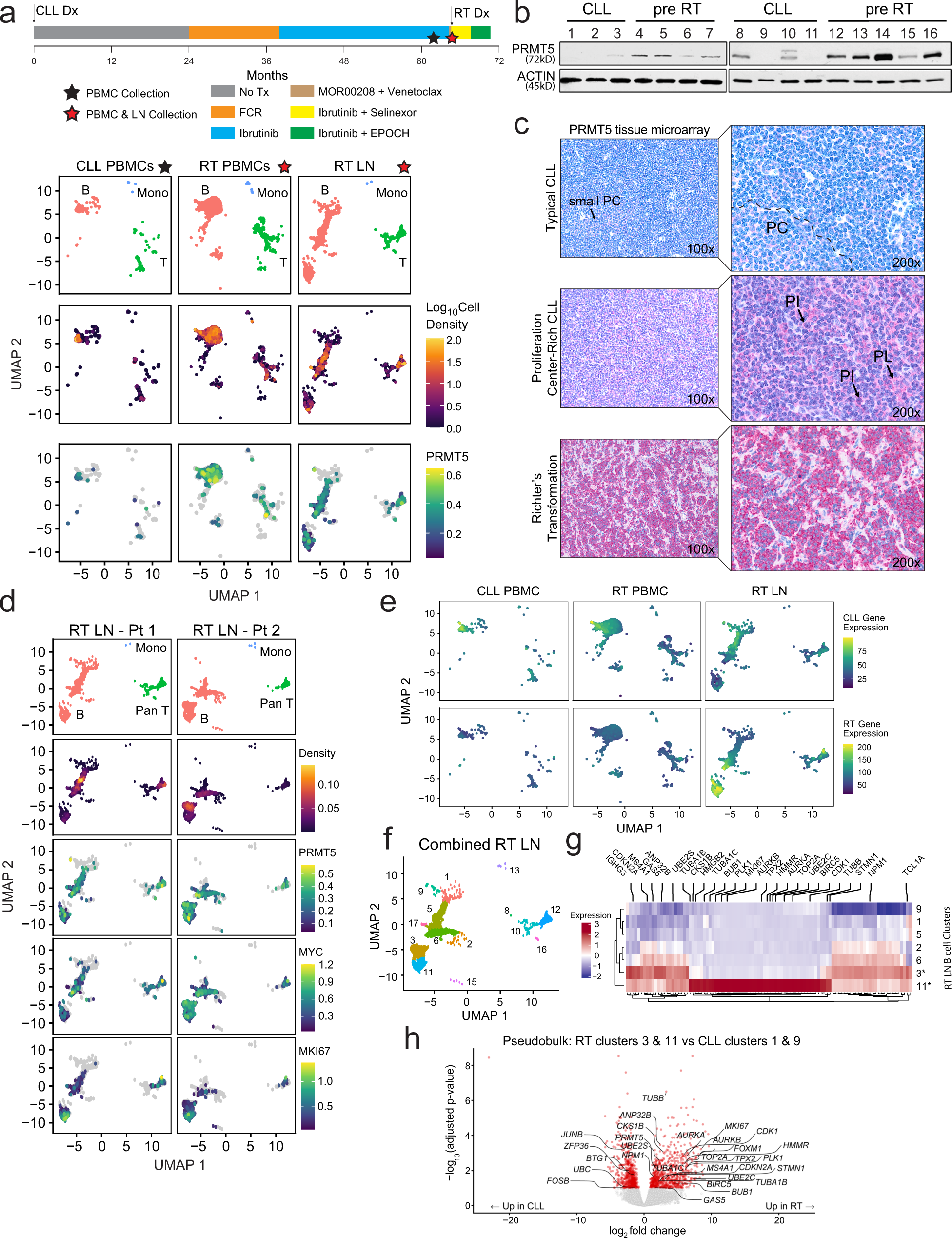 Dysregulation of PRMT5 in chronic lymphocytic leukemia promotes progression  with high risk of Richter's transformation | Nature Communications