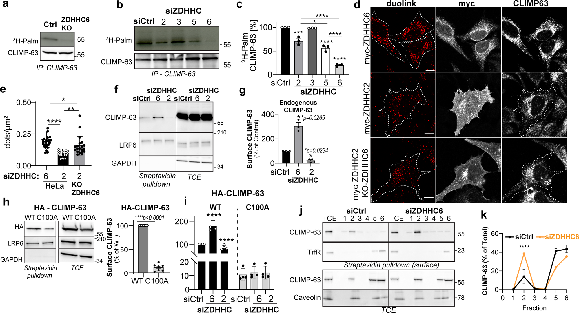 Fig. 2: ZDHHC6 palmitoylates CLIMP-63 and retains it at the ER.