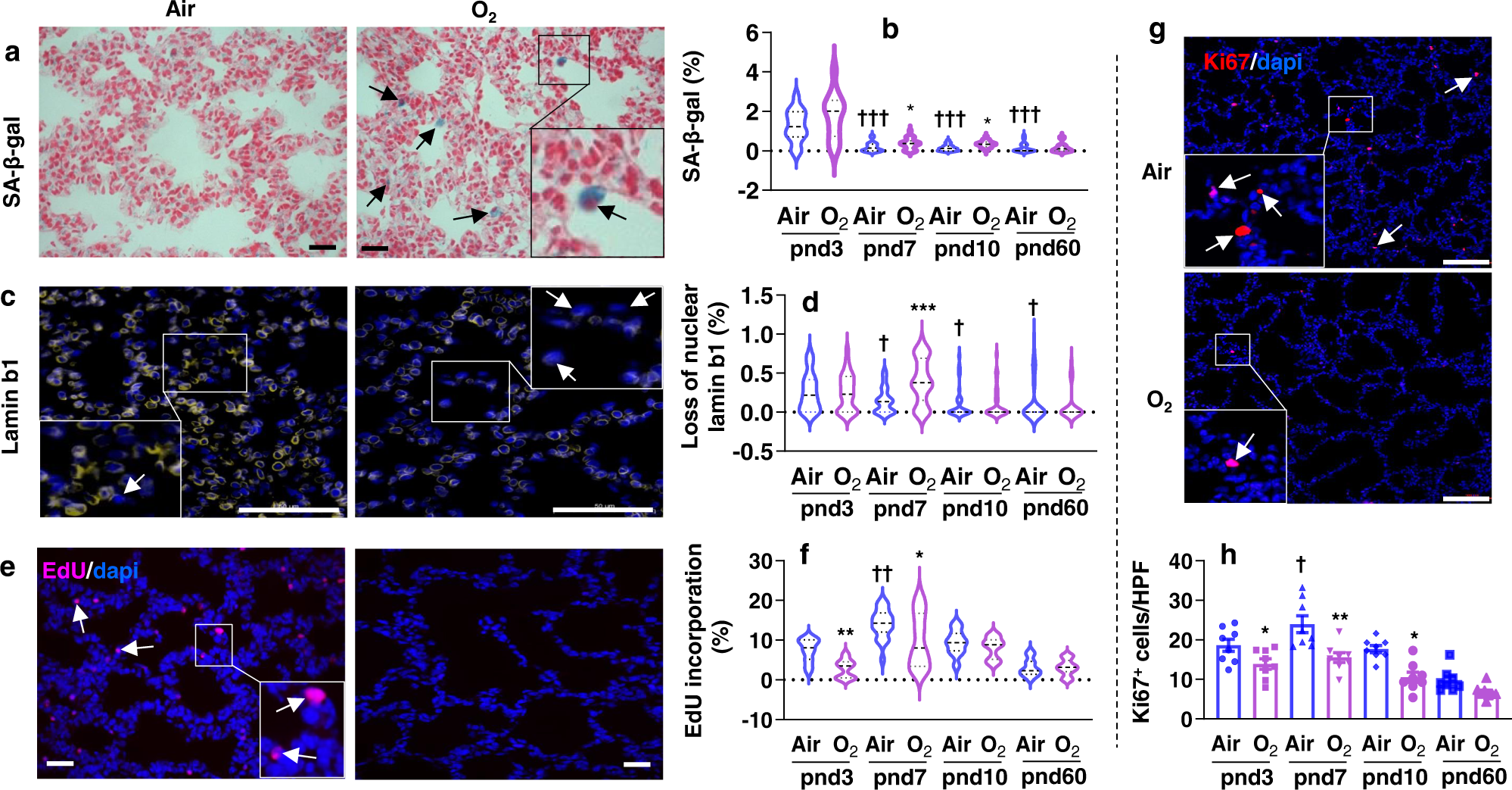 Timing and cell specificity of senescence drives postnatal lung development  and injury | Nature Communications