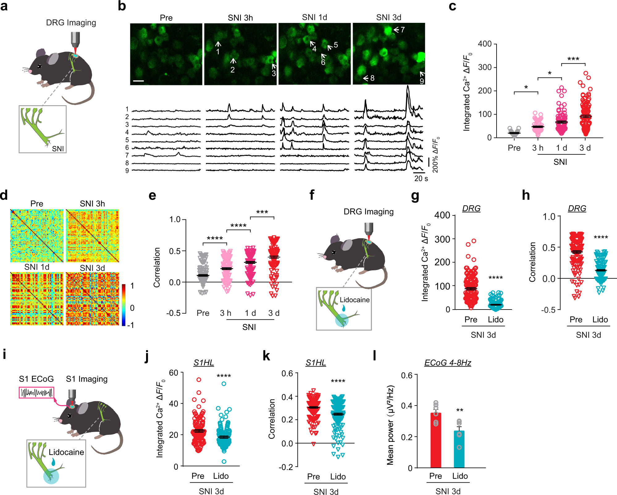 Fig. 2: Peripheral nerve injury induces activity synchrony in DRG neurons prior to pyramidal neurons in S1.