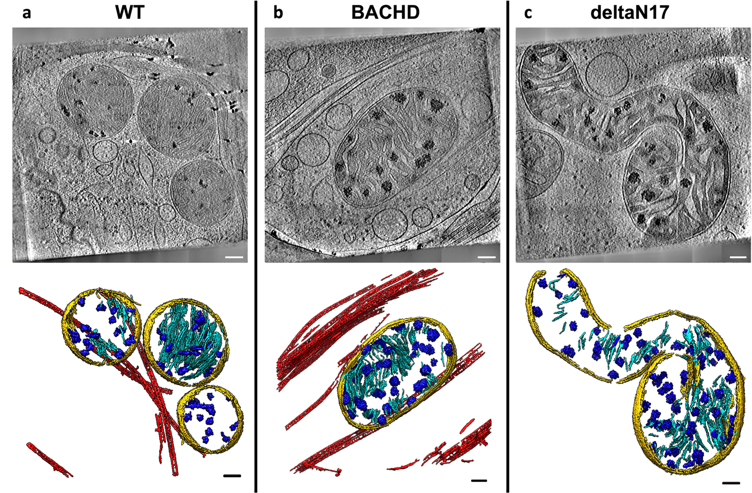 Fig. 3: Mitochondria from neurites of HD mouse model neurons exhibit altered morphology and contain enlarged granules of varying size.