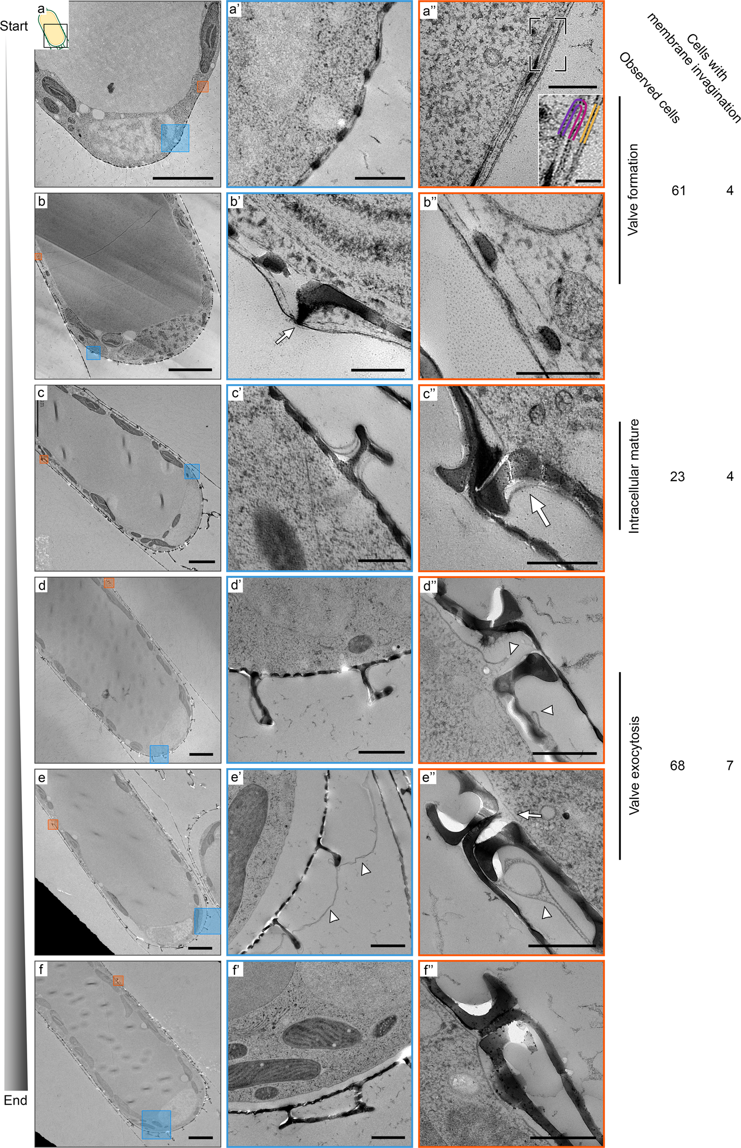 Fig. 3: TEM images showing sequential stages of valve formation and exocytosis in S. turris.