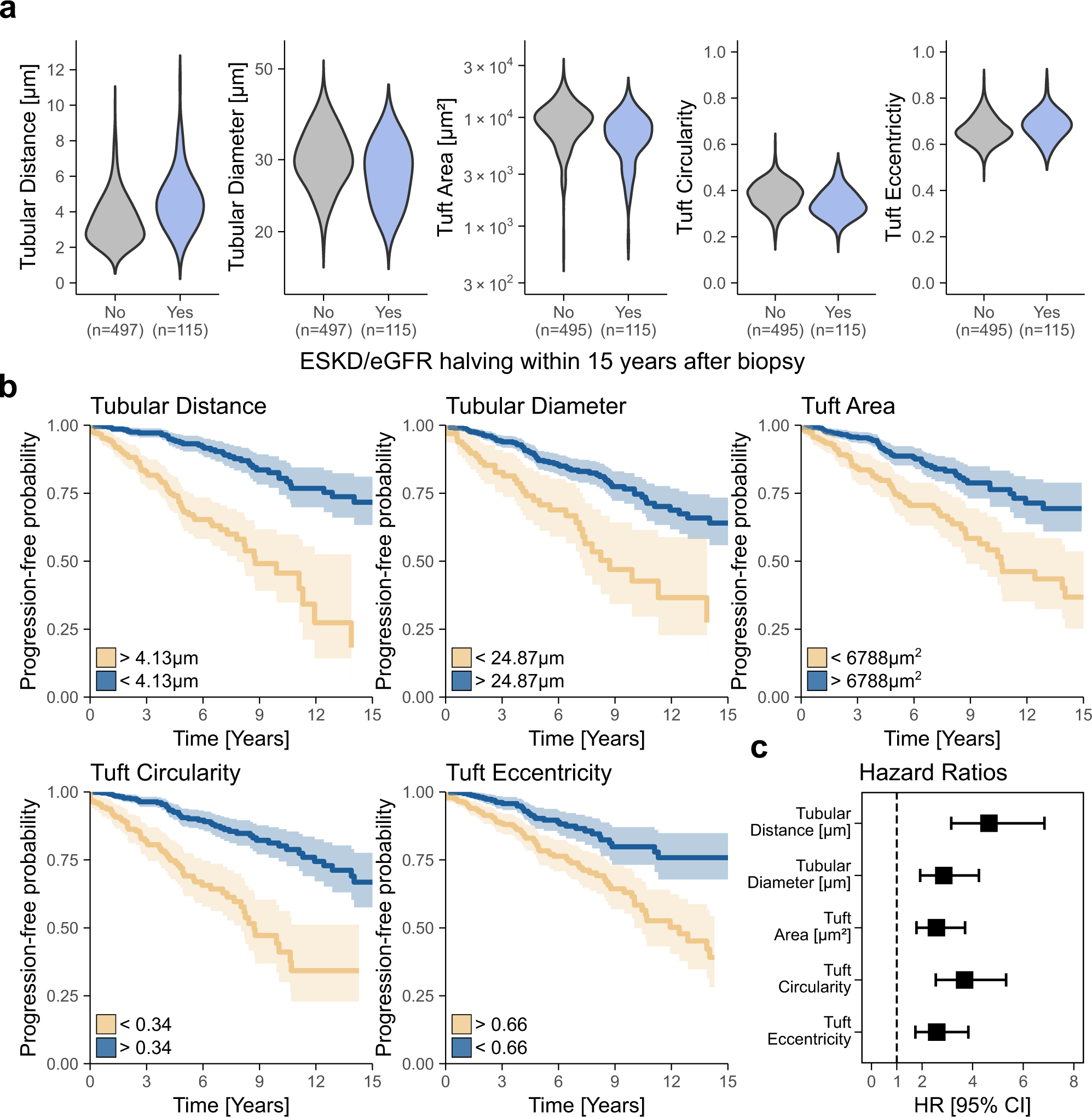 Fig. 4: NGM-derived quantitative features are predictive of disease progression in IgA nephropathy (IgAN).