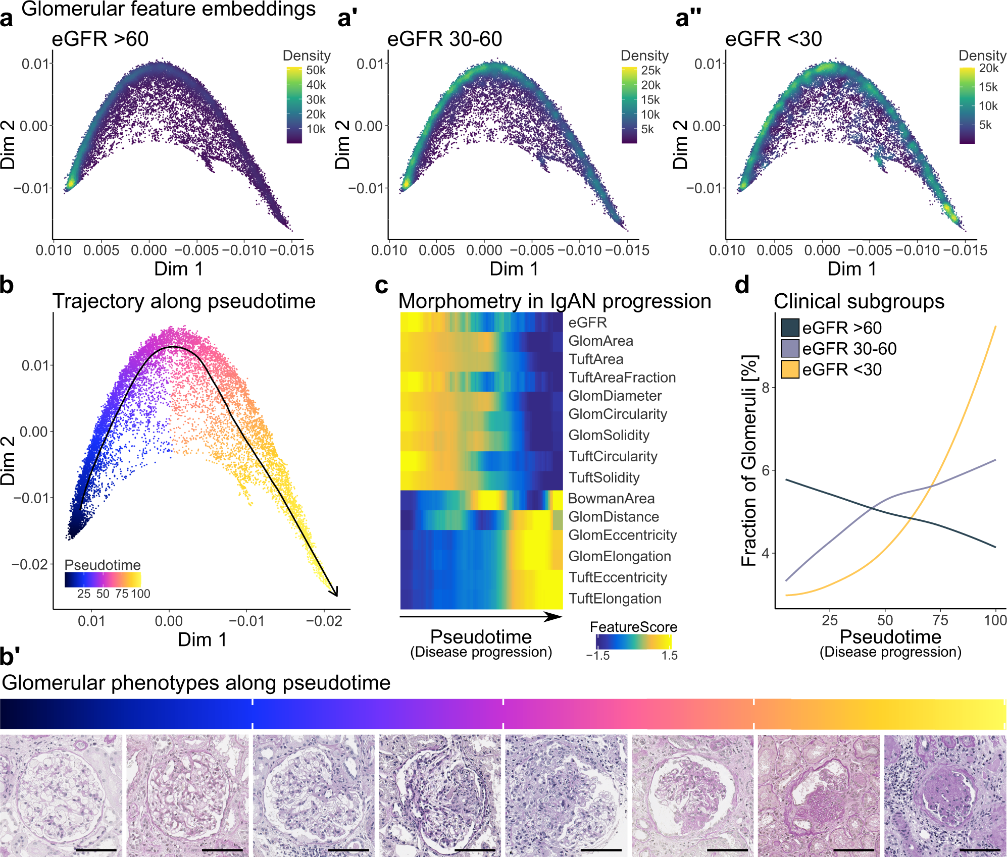 Fig. 5: Pseudotime analysis of NGM-derived glomerular features identifies distinct glomerular groups along a trajectory of disease progression in IgA nephropathy (IgAN).