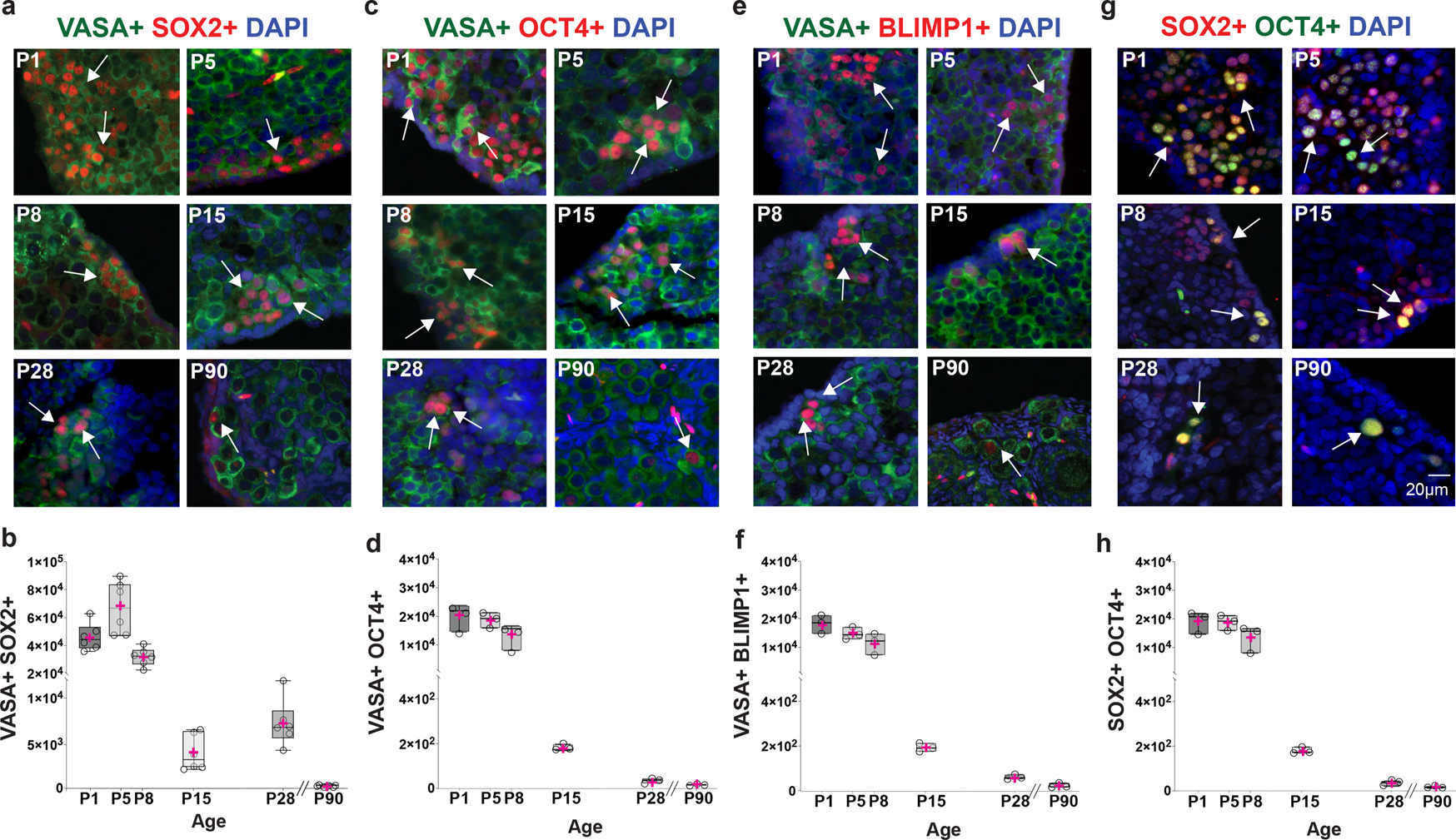 Fig. 2: Presence of pluripotency and primordial germ cell markers in postnatal naked mole-rat (NMR) ovaries.