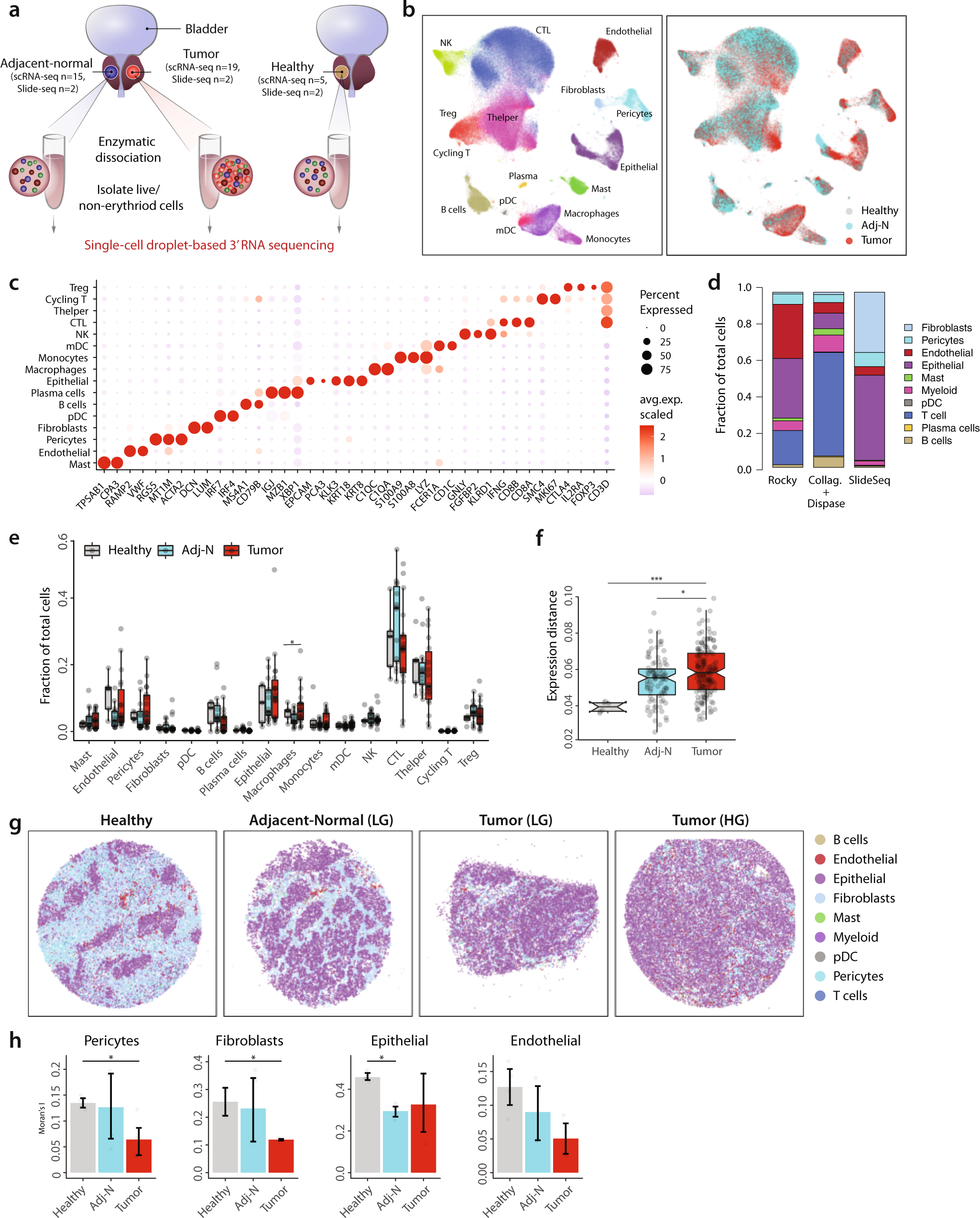 Cellular heterogeneity and immune microenvironment revealed by