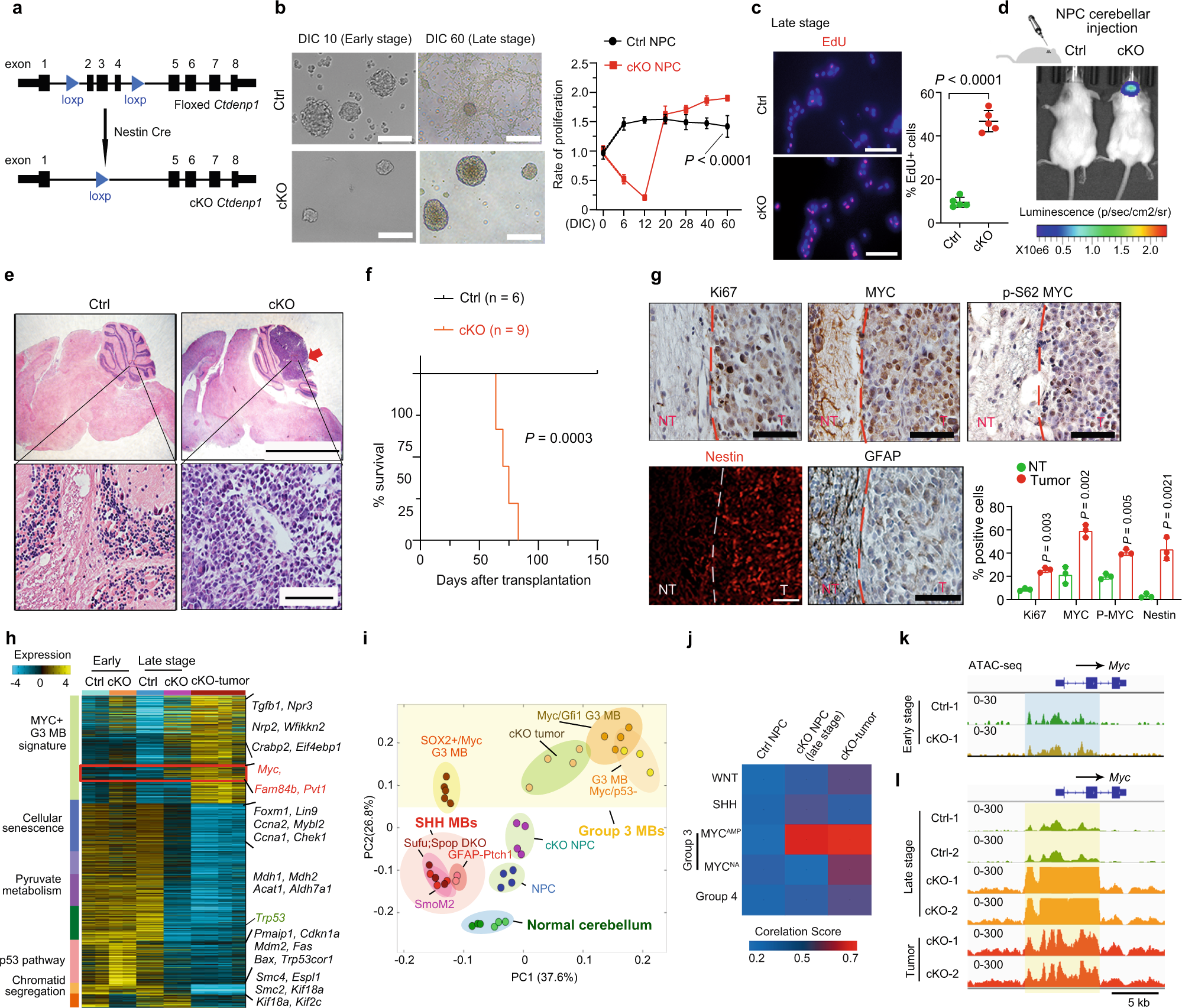 Fig. 4: Ctdnep1 ablation in cerebellar NPCs induces G3 MB-like tumor formation.