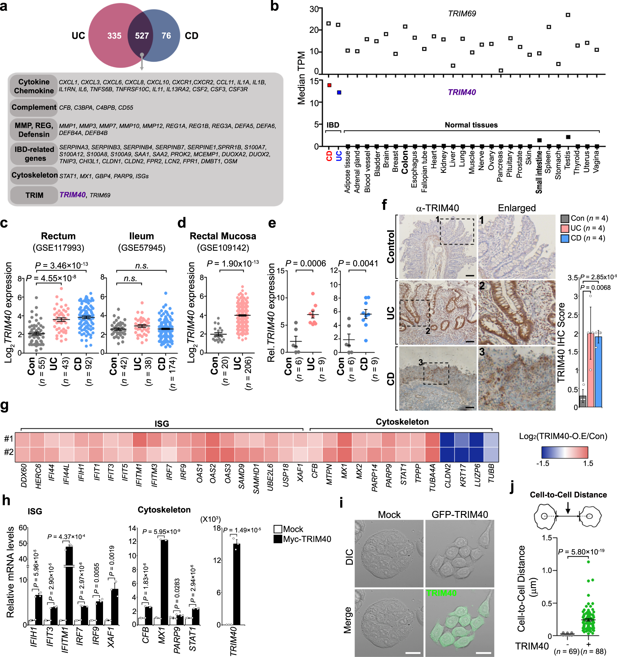 Fig. 1: TRIM40 upregulation is associated with IBD pathogenesis through morphological and cytoskeletal alterations.