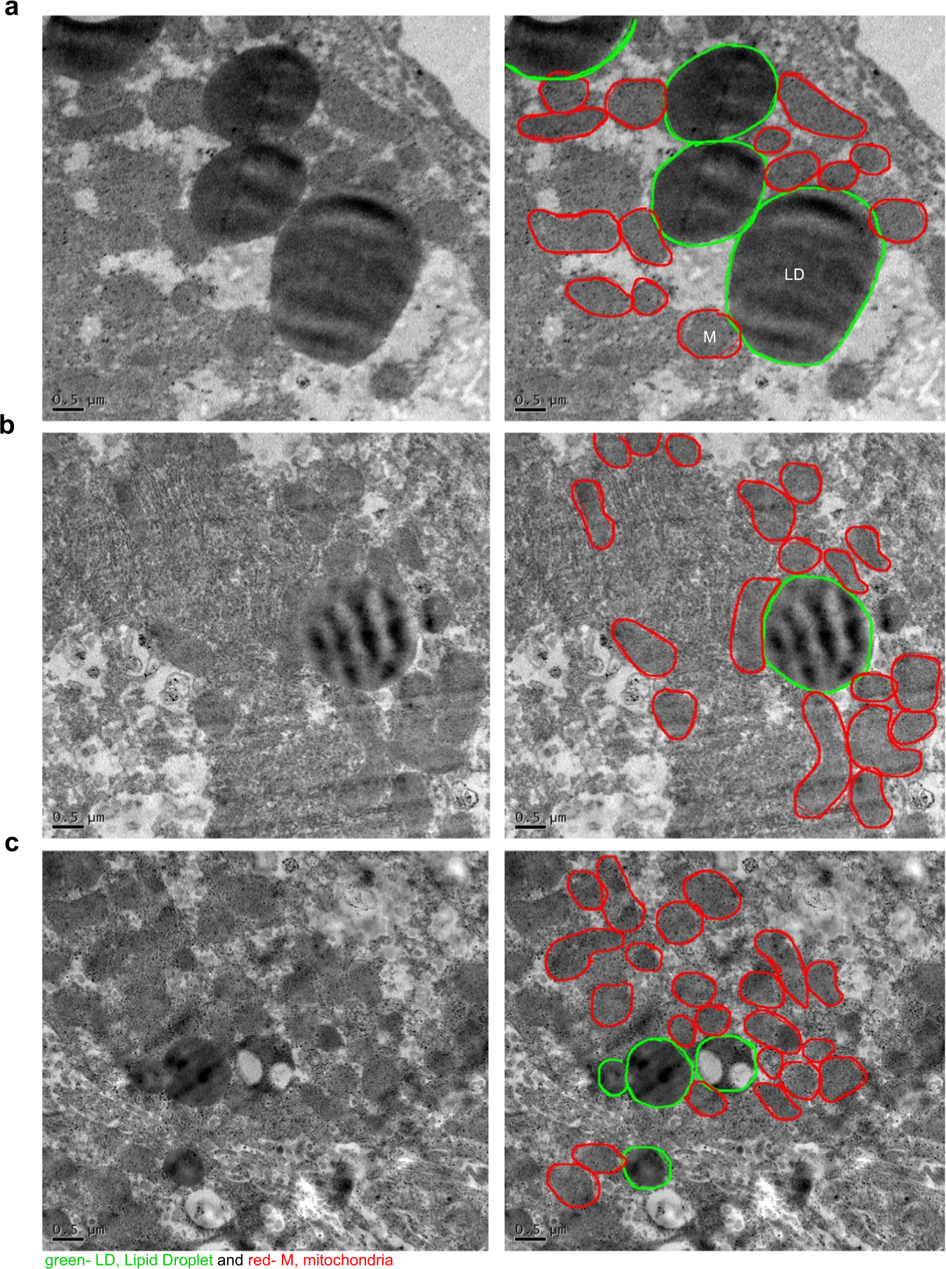 Lipid-droplet associated mitochondria promote fatty-acid oxidation through a distinct bioenergetic pattern in male Wistar rats Nature Communications