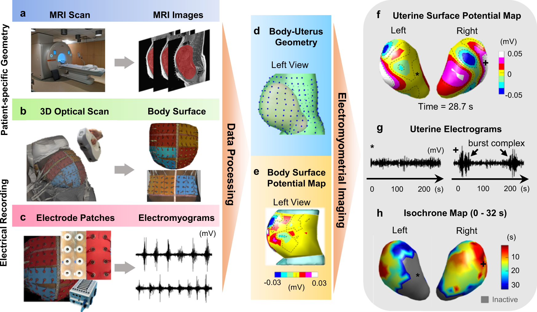 Noninvasive electromyometrial imaging of human uterine maturation during  term labor | Nature Communications