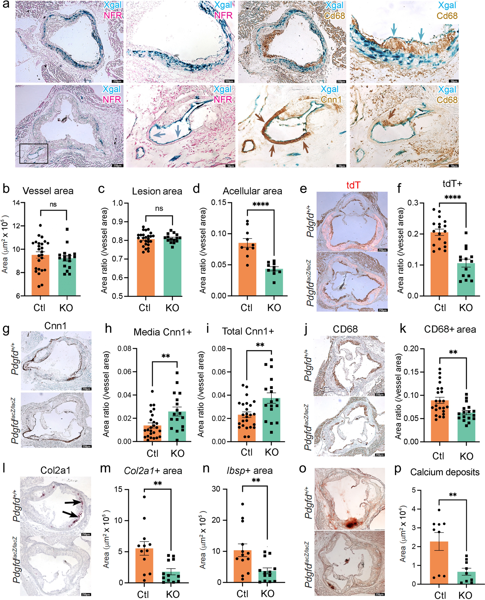 Fig. 5: In situ studies of mouse atherosclerosis reveal that Pdgfd KO lessens SMC cell state transitions and inflammation but without impact on plaque burden.