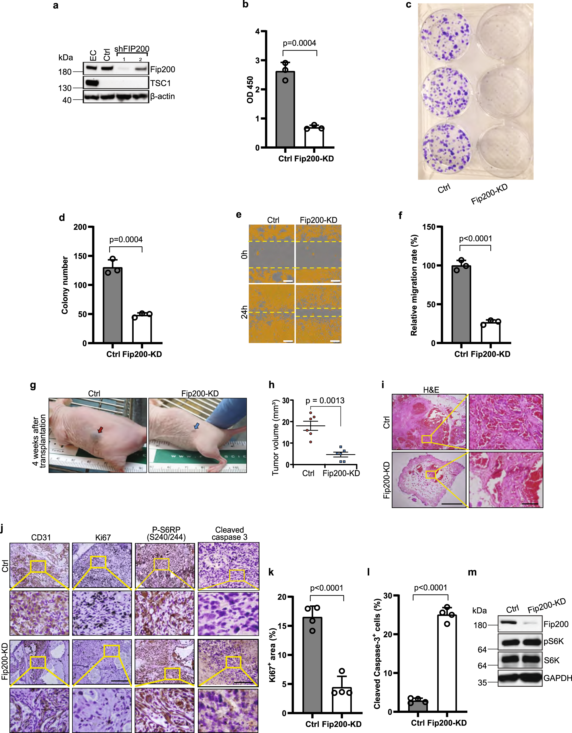 Fig. 2: Fip200 knockdown decreases vascular tumour cell proliferation, migration and tumorigenicity.