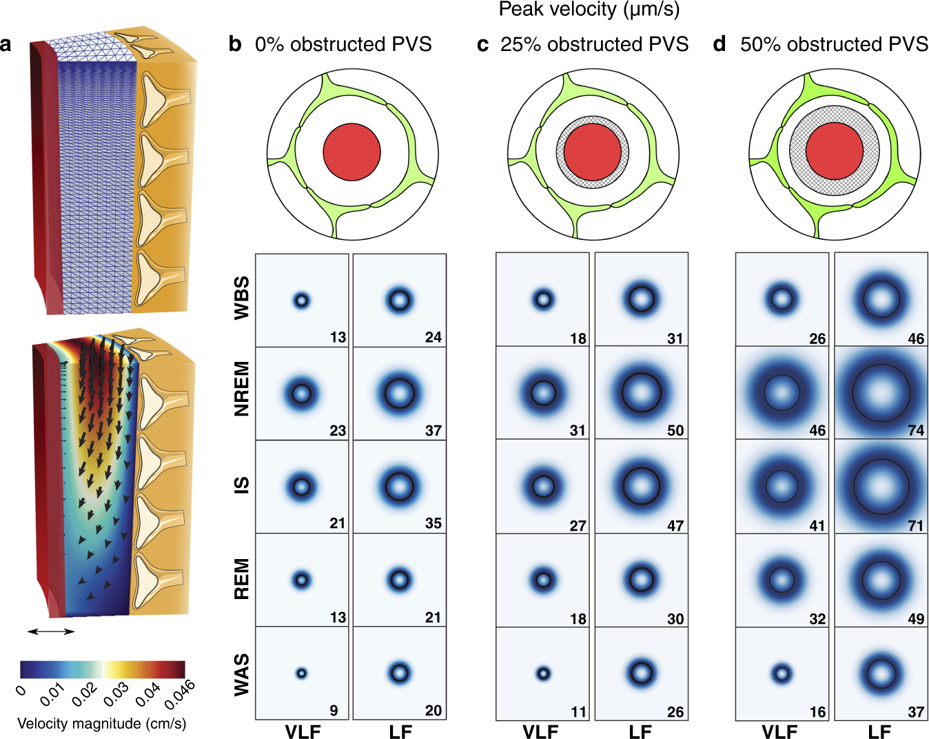 a Illustration showing the model of the PVS (top), and representative vasomotion-driven CSF flow simulation (bottom). b–d Peak fluid velocity in penetrating arteriole PVS generated by VLF and LF oscillations during a sleep cycle as predicted by biomechanical modeling using three scenarios where we added a fixed volume to the PVS obstructing flow corresponding to 0, 25, and 50% of our measured PVS in quiet wakefulness. The black circle represents the median, whereas the shading represents the distribution of all modeled vessels (n = 16 vessels, 4 mice). The value of the median is also given in the lower right corner for each box. WBS wake before sleep; NREM non-rapid eye movement sleep; IS intermediate state sleep; REM rapid eye movement sleep; WAS wake after sleep; PVS perivascular space; VLF very low frequency; LF low frequency. 