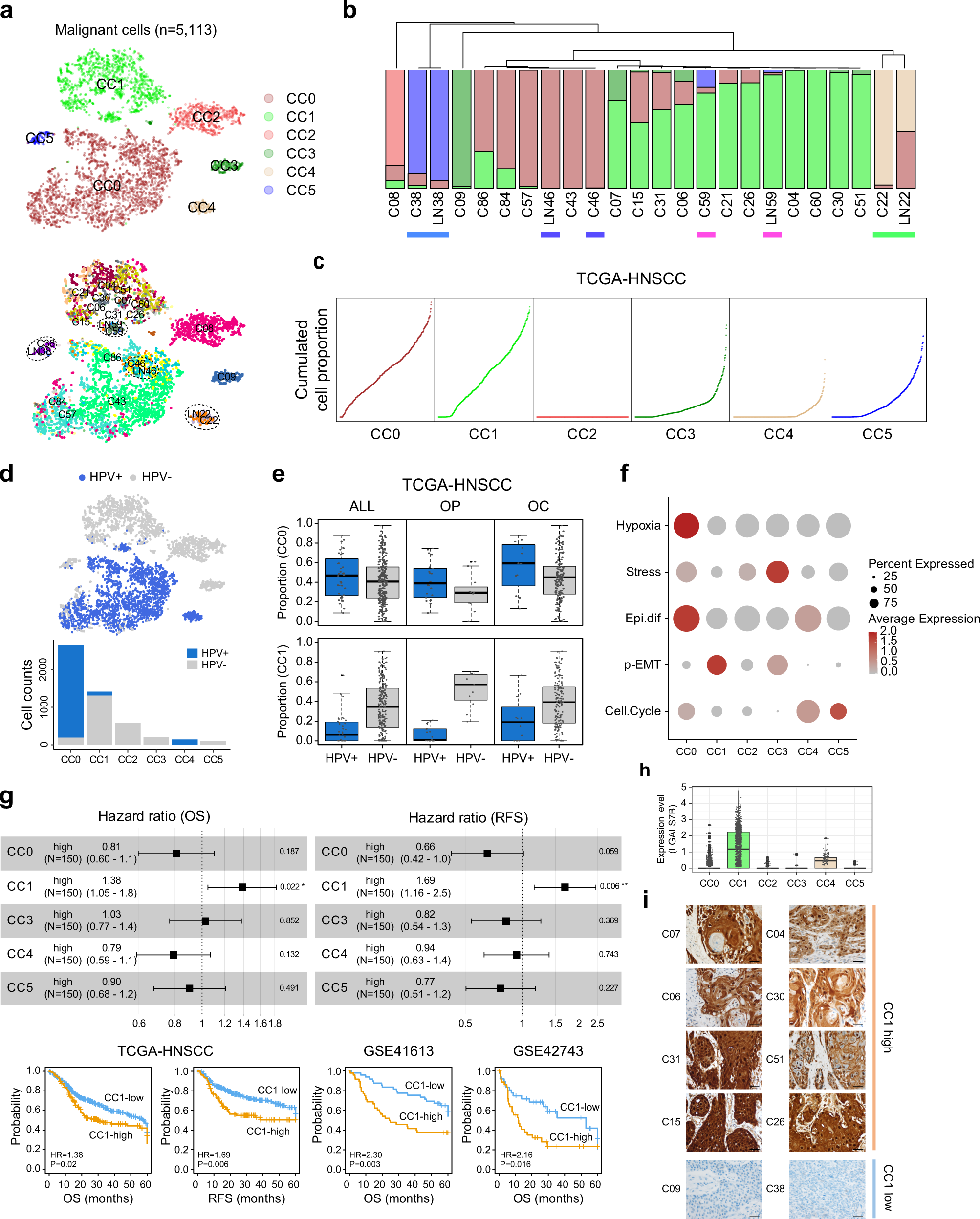 Fig. 3: Malignant cell cluster with LGALS7 expression shows an aggressive phenotype.