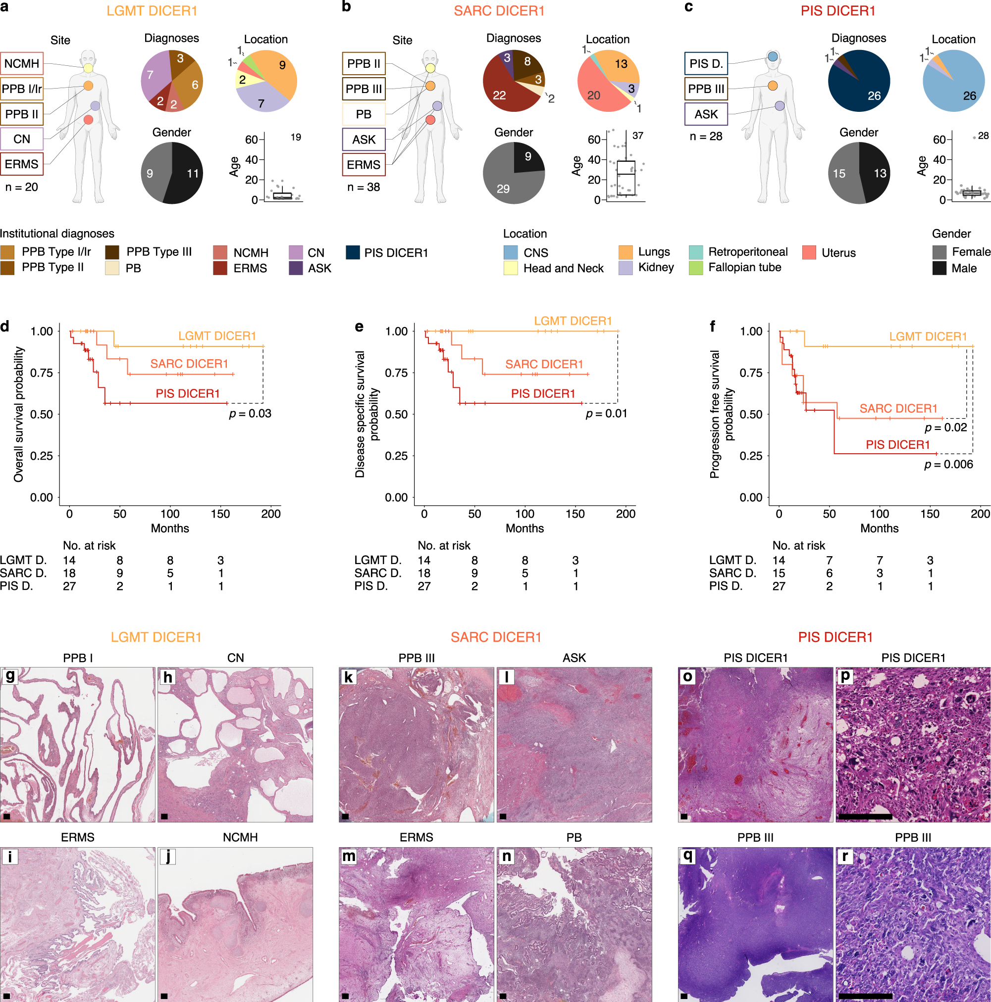 Fig. 2: Clinicopathological features of mesenchymal neoplasms with DICER1 alteration.