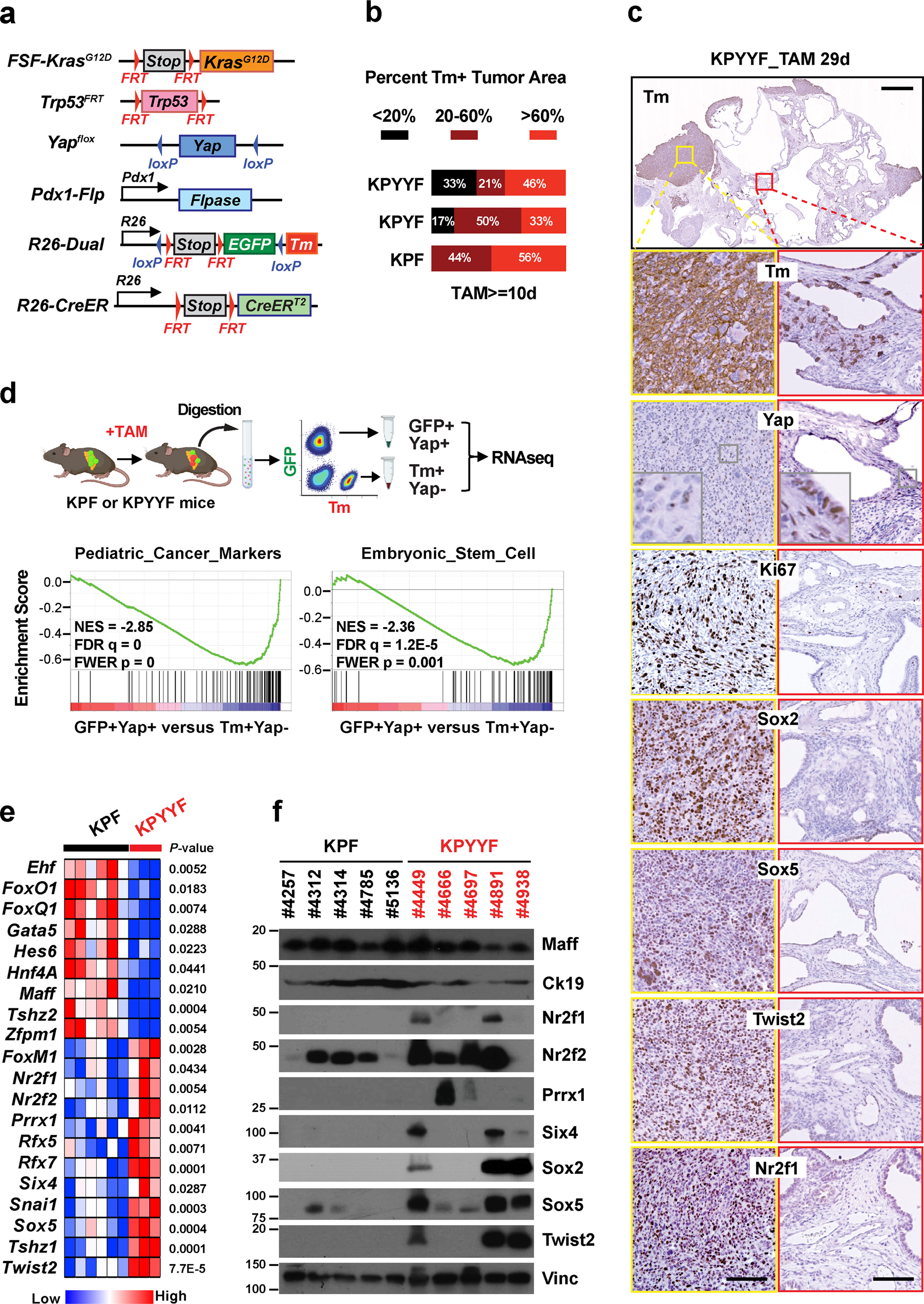 Fig. 1: A subset of Kras:p53 mutant PDAC tumors develop spontaneous relapsed lesions with embryonic progenitor features following Yap ablation.
