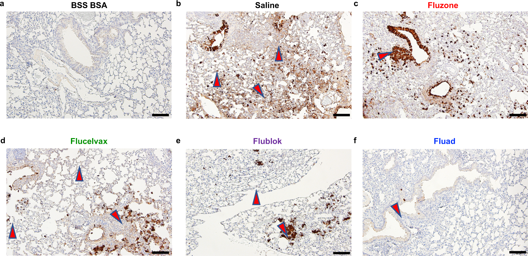 Fig. 7: Histopathology in mice lungs following vaccination with commercial influenza vaccines and subsequent challenge with H1N1 influenza virus.