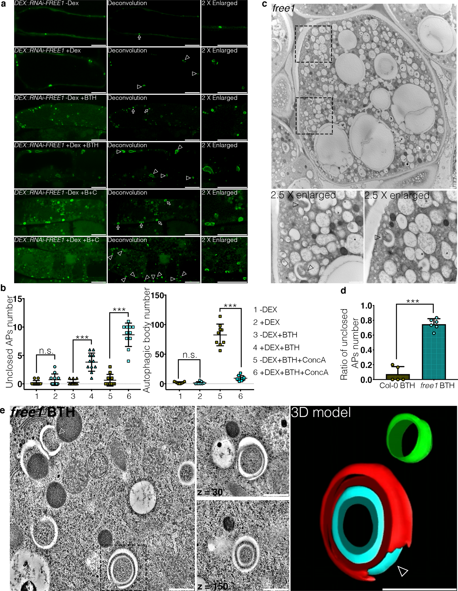 Perforar Sensación Paternal The plant unique ESCRT component FREE1 regulates autophagosome closure |  Nature Communications