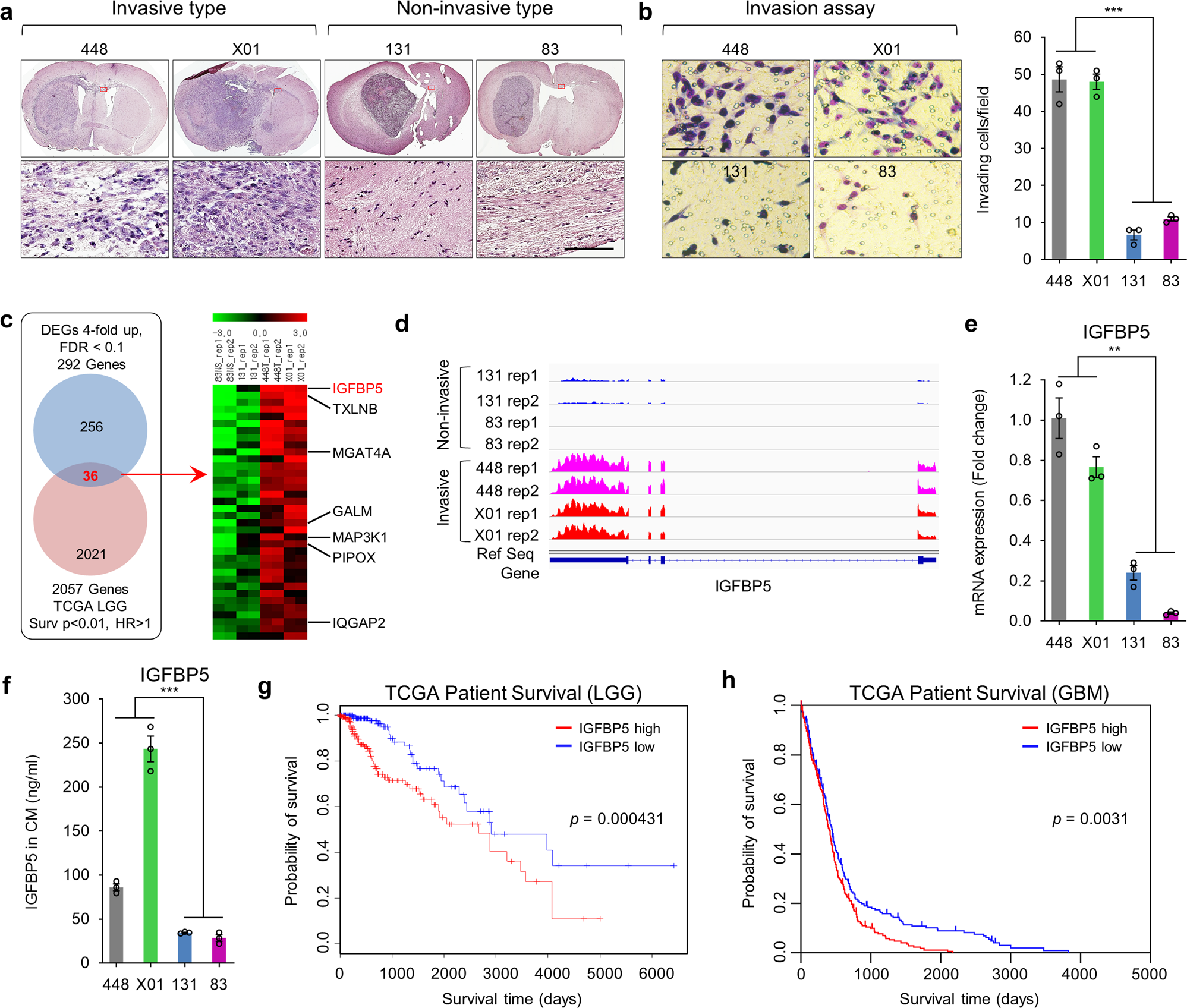 Fig. 1: IGFBP5 expression is associated with GSCs invasion and patient survival in glioma.