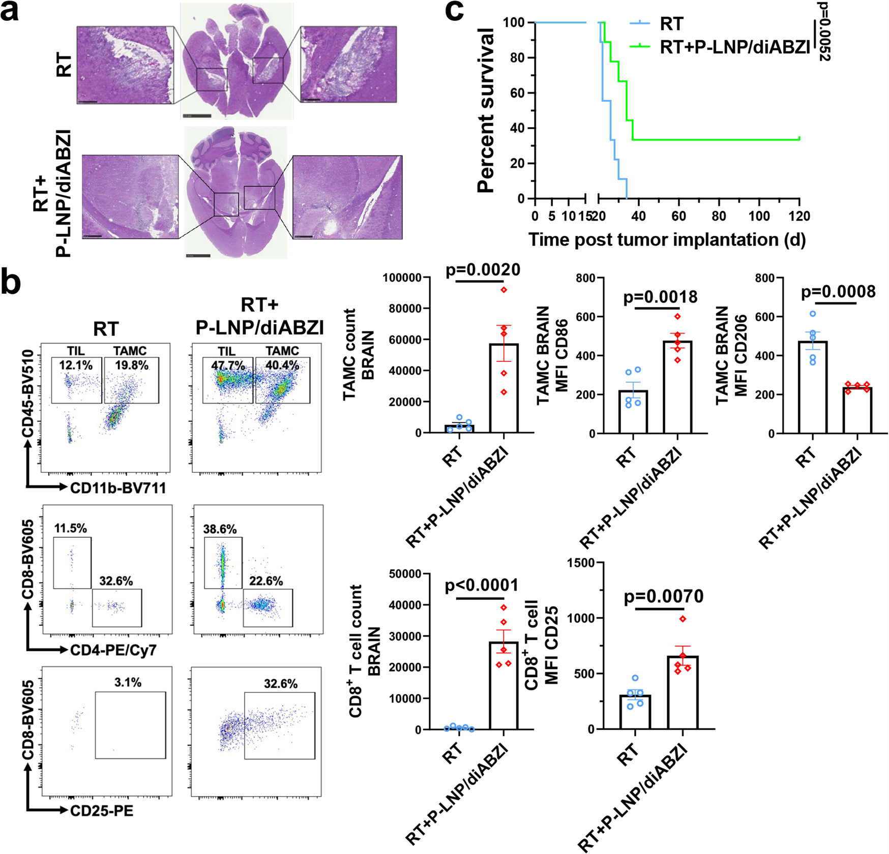 Fig. 10: Nanoparticle treatment reshapes immune microenvironment and potentiates the therapeutic effects of radiotherapy in PVPF8 murine gliomas.