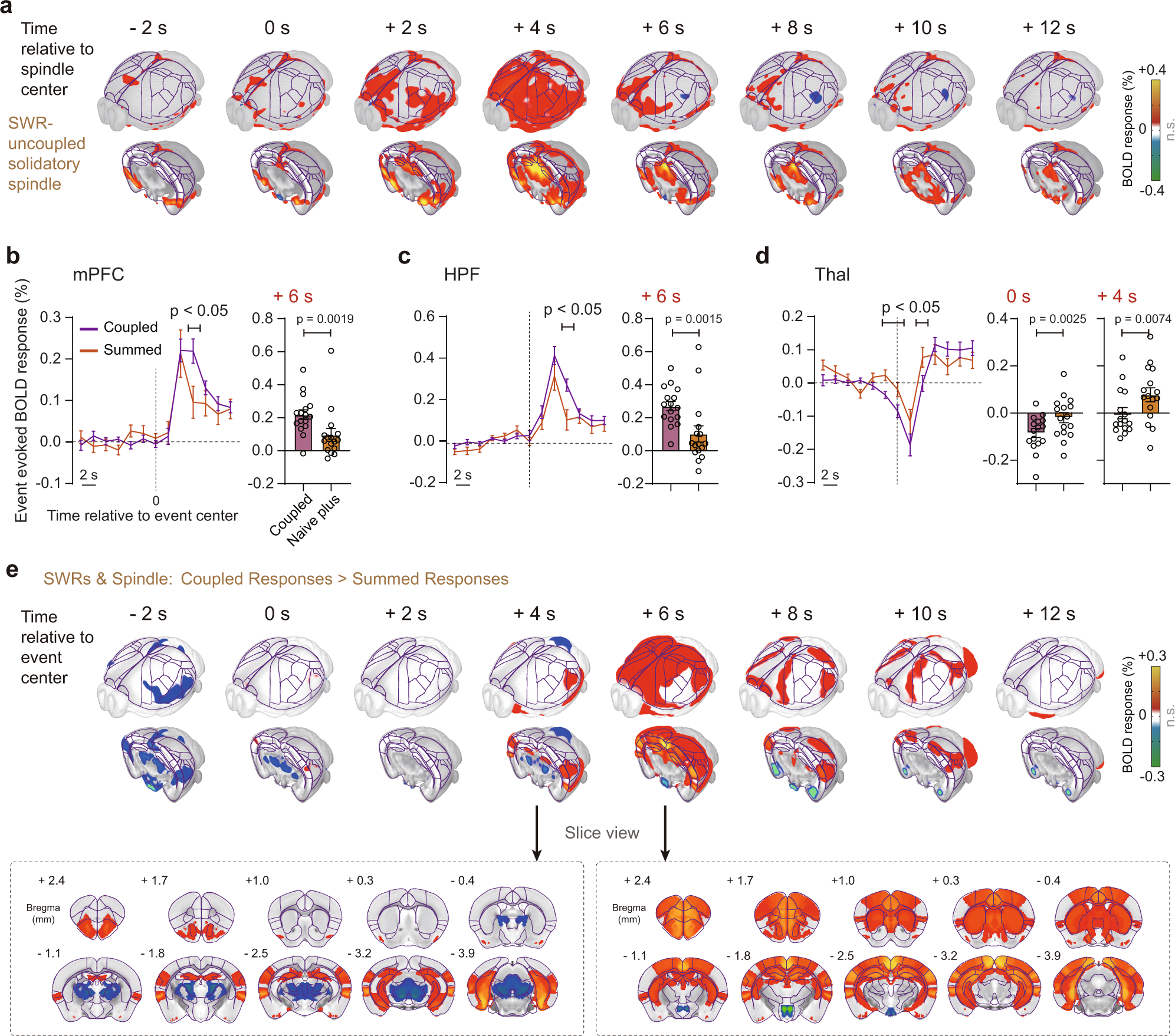 Fig. 8: Synergistic effects of SWR-spindle coupling.