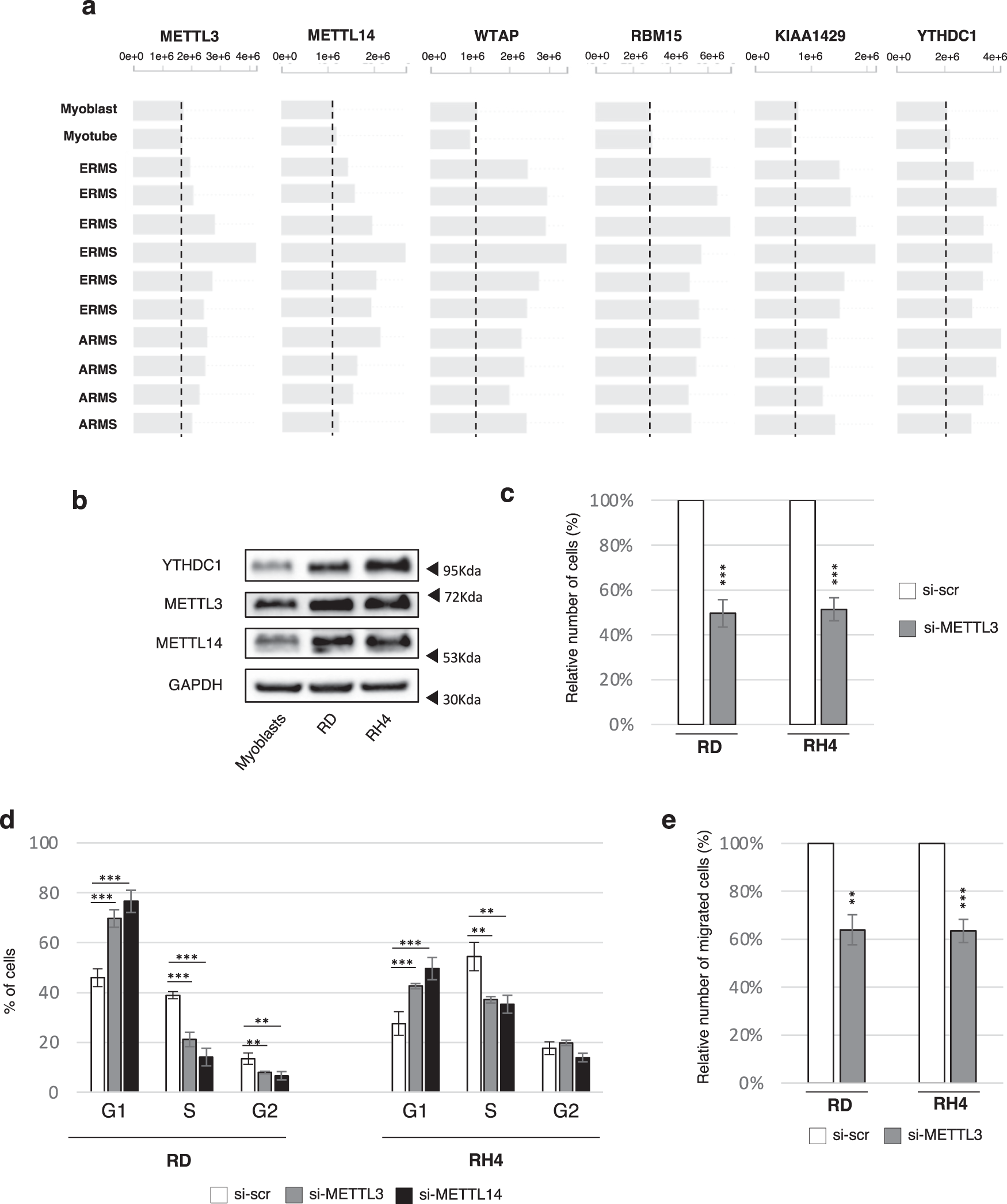 Fig. 2: m6A factors are altered in RMS and sustain its proliferation and migration rate.