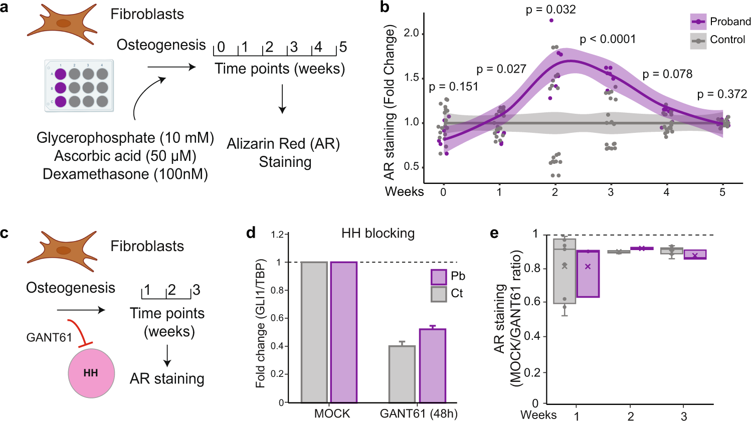 Fig. 6: Osteogenic differentiation in fibroblasts from the patient and controls.