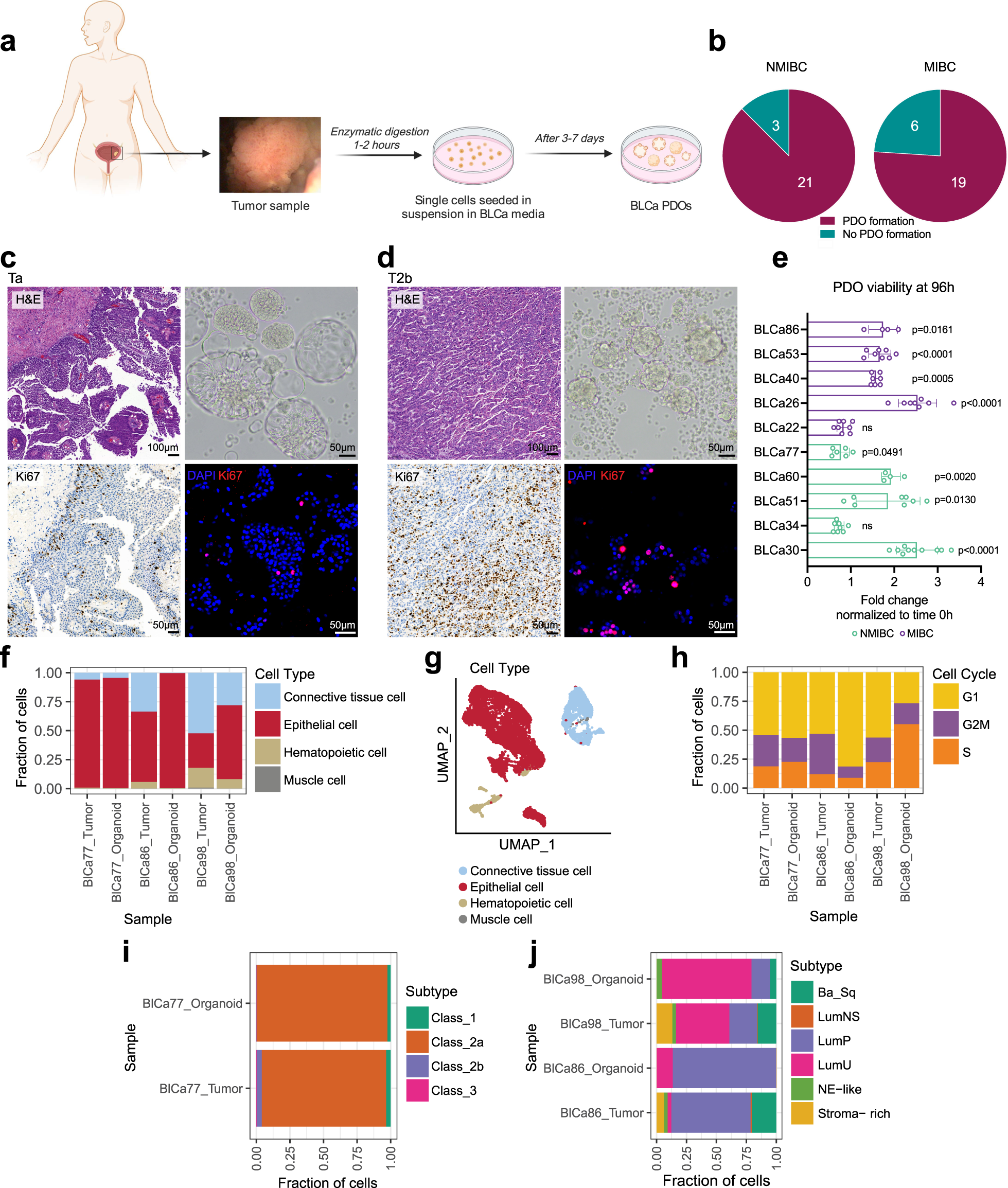 Fig. 1: Isolation and culture of patient-derived organoids (PDOs) from non-muscle invasive bladder cancer (NMIBC) and muscle invasive bladder cancer (MIBC).