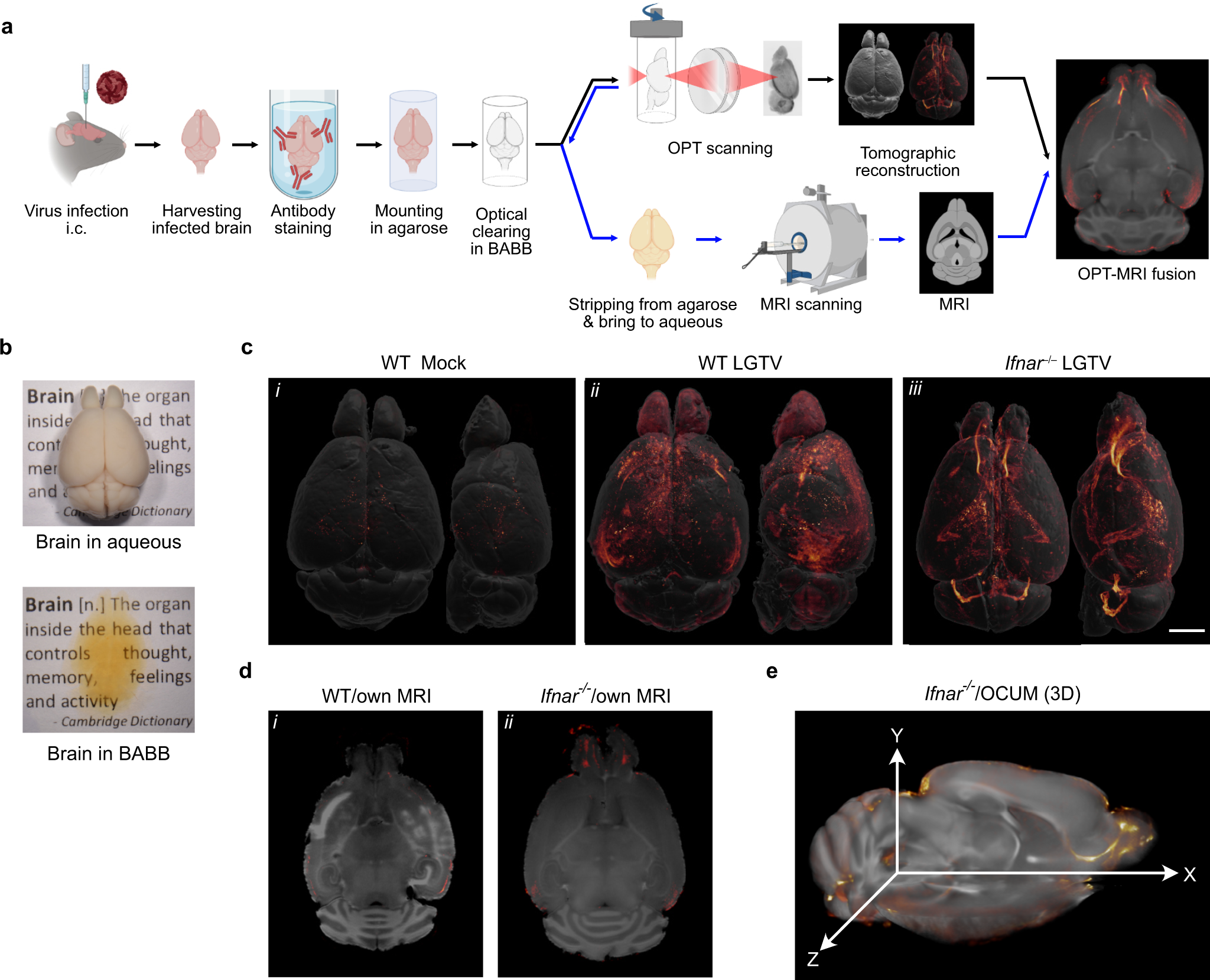 Man Develops Near-Fatal Infection in Brain Lining After Using