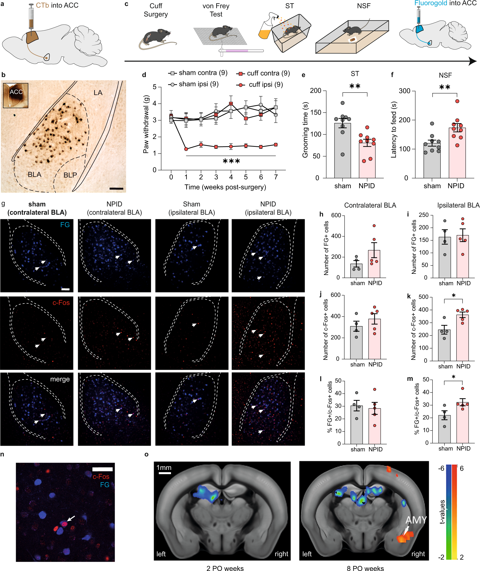 The basolateral amygdala-anterior cingulate pathway contributes to  depression-like behaviors and comorbidity with chronic pain behaviors in  male mice | Nature Communications