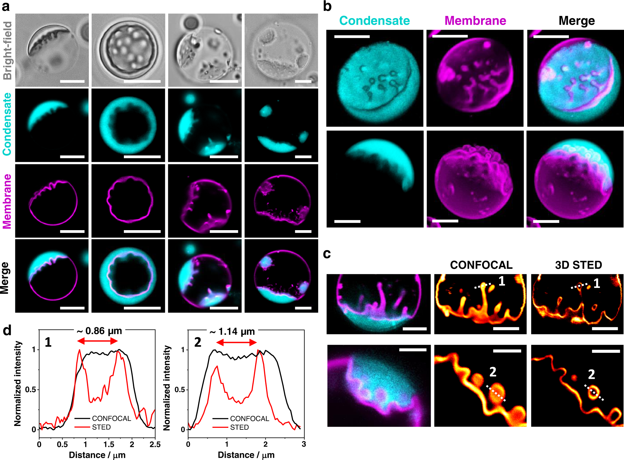 Fig. 6: Ruffling and fingering of the membrane-condensate interface leads to complex morphologies.