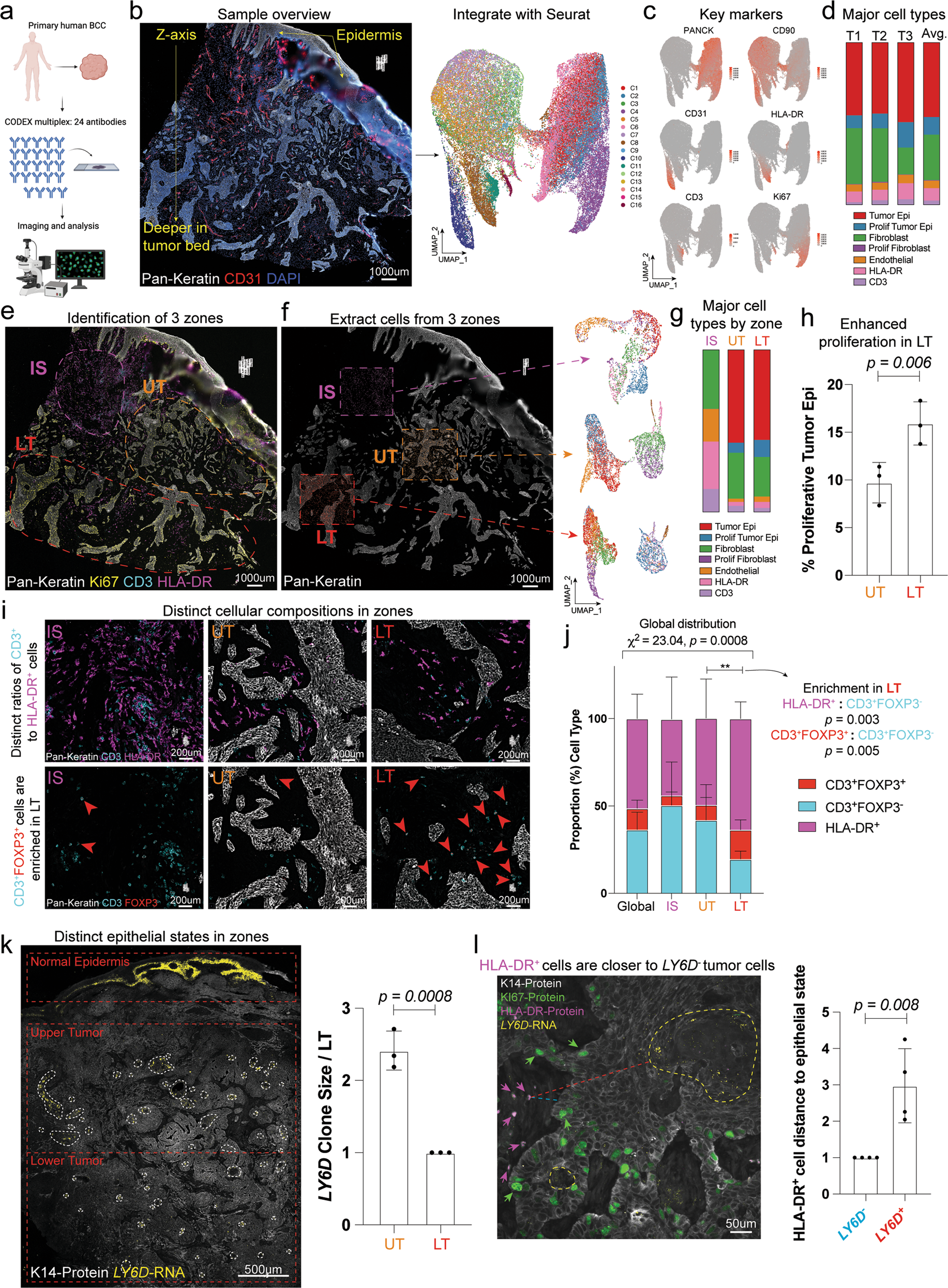 Skin basal cell carcinomas assemble a pro-tumorigenic spatially organized  and self-propagating Trem2+ myeloid niche | Nature Communications