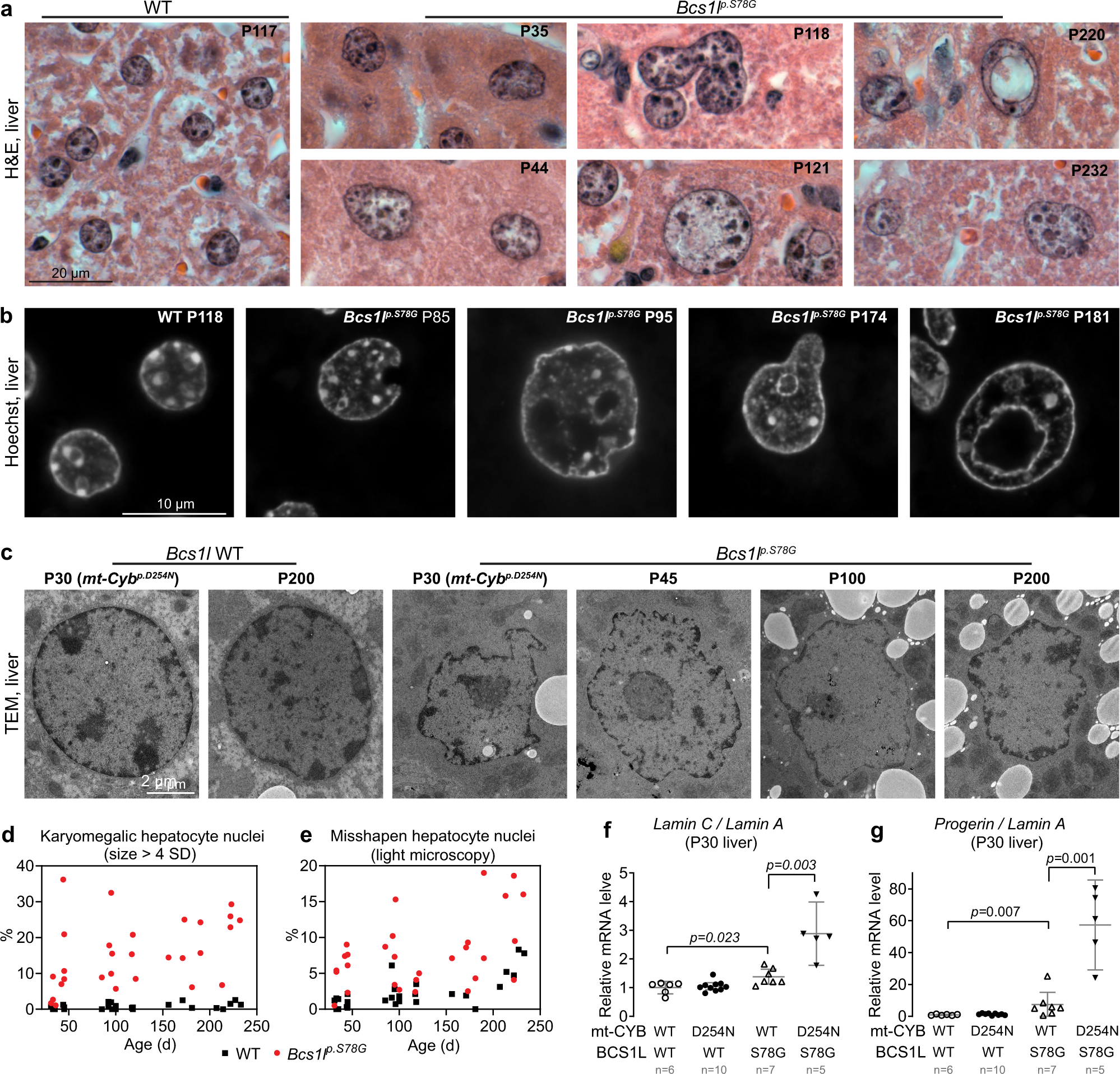 Fig. 3: Morphological aberrations of CIII-deficient hepatocyte nuclei.