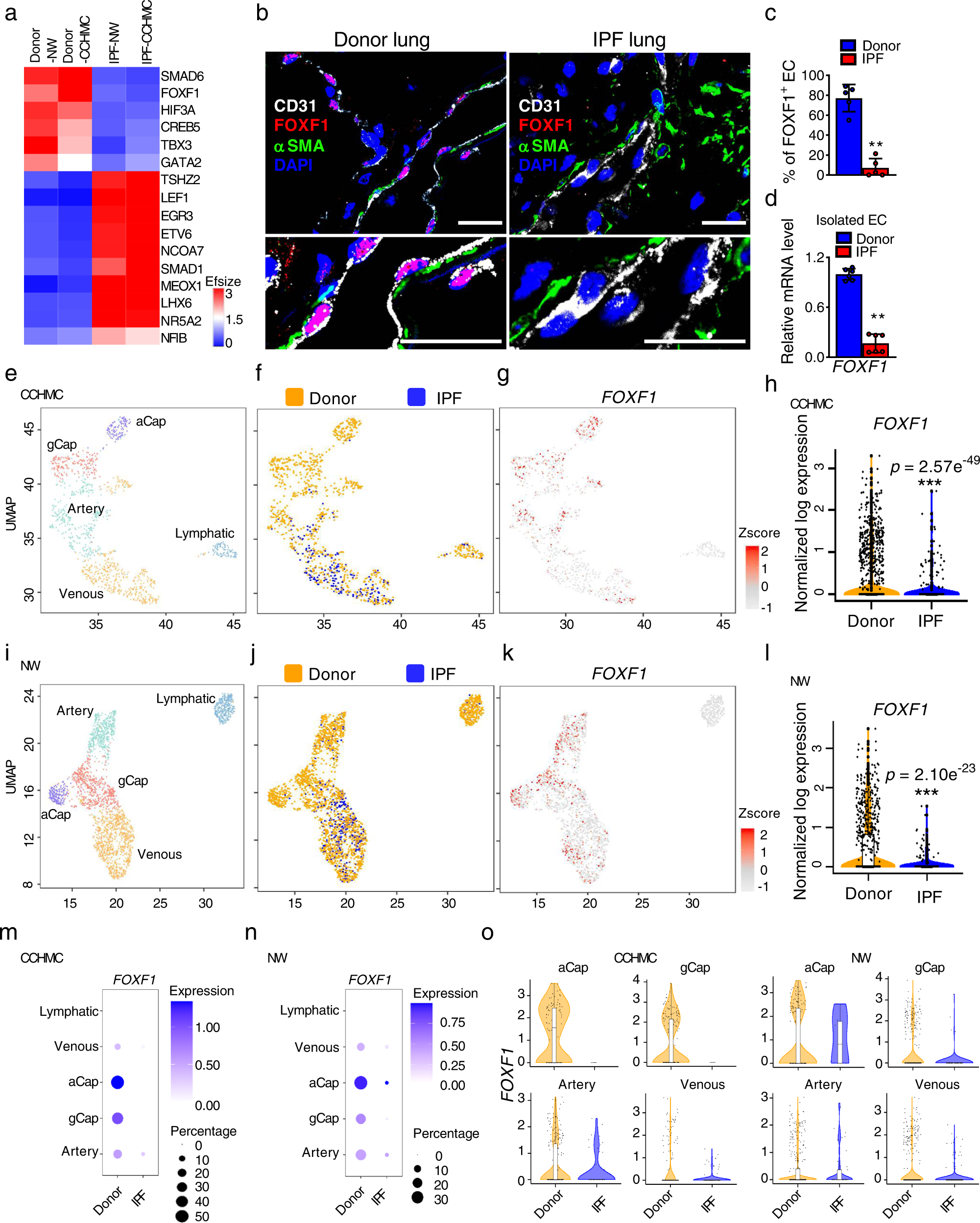 Lung extracellular matrix modulates KRT5+ basal cell activity in pulmonary  fibrosis