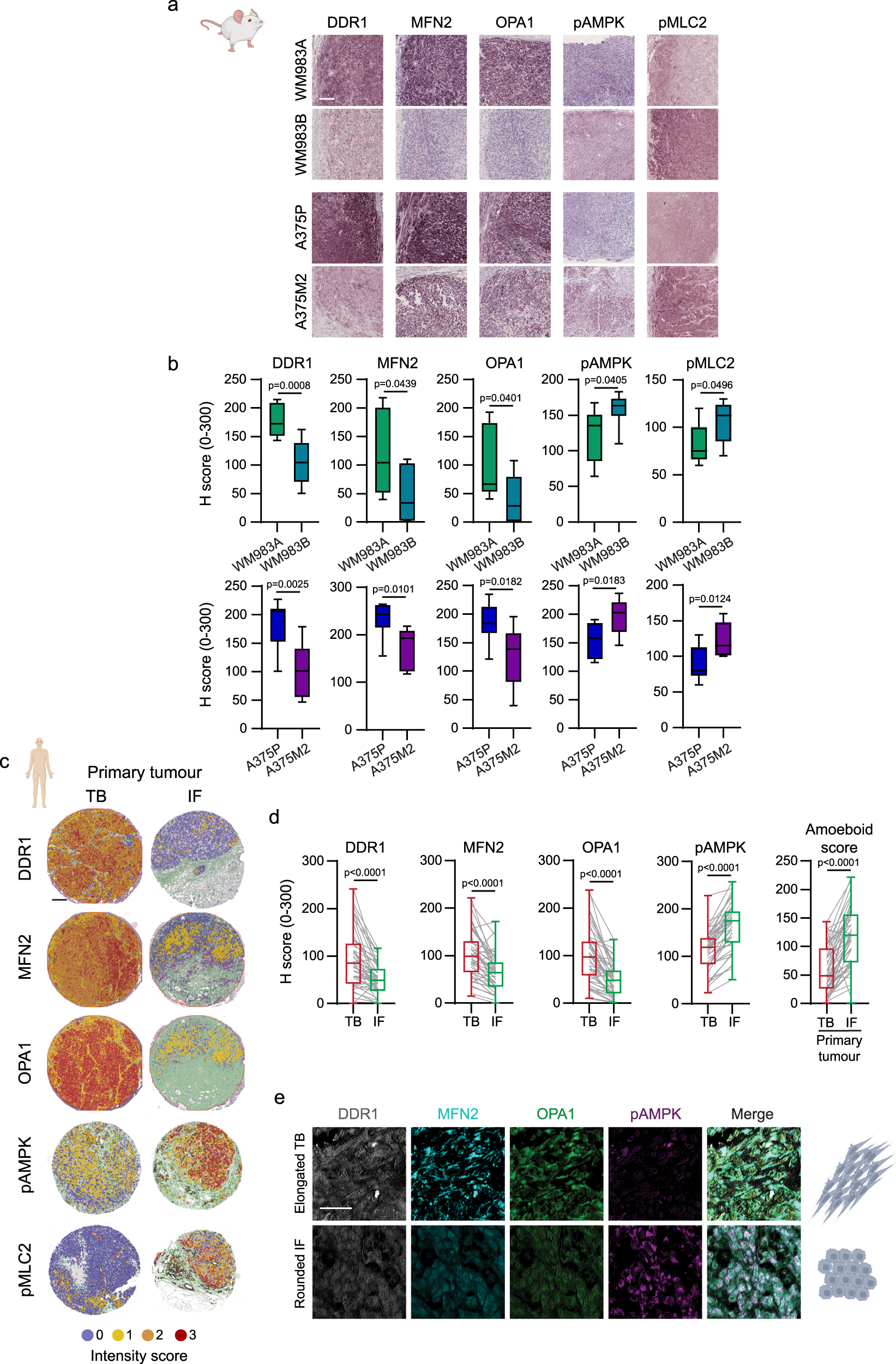 Fig. 8: Adhesion, AMPK and mitochondrial dynamics in vivo and in primary melanoma tissues.