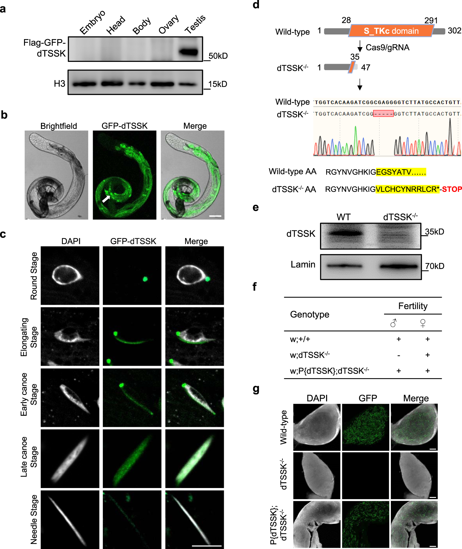 Broad phosphorylation mediated by testis-specific serine/threonine kinases contributes to spermiogenesis and male fertility Nature Communications picture
