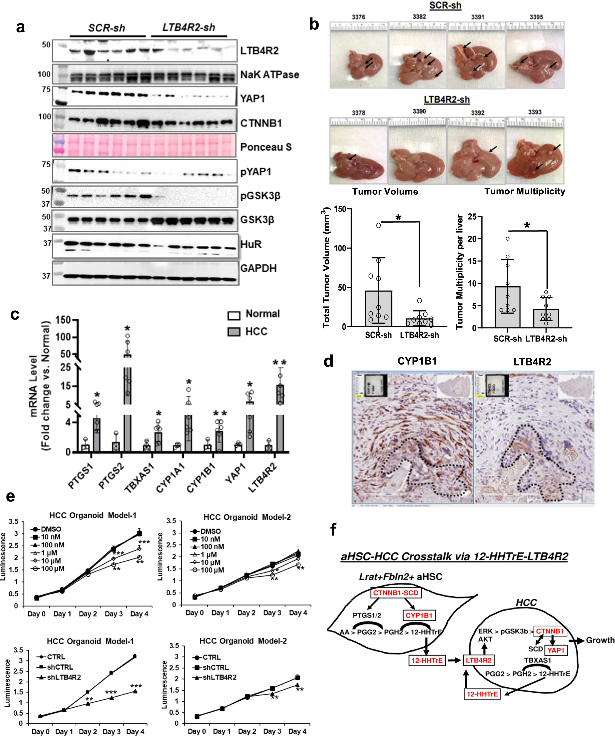 Fig. 4: HCC growth is dependent on LTB4R2.
