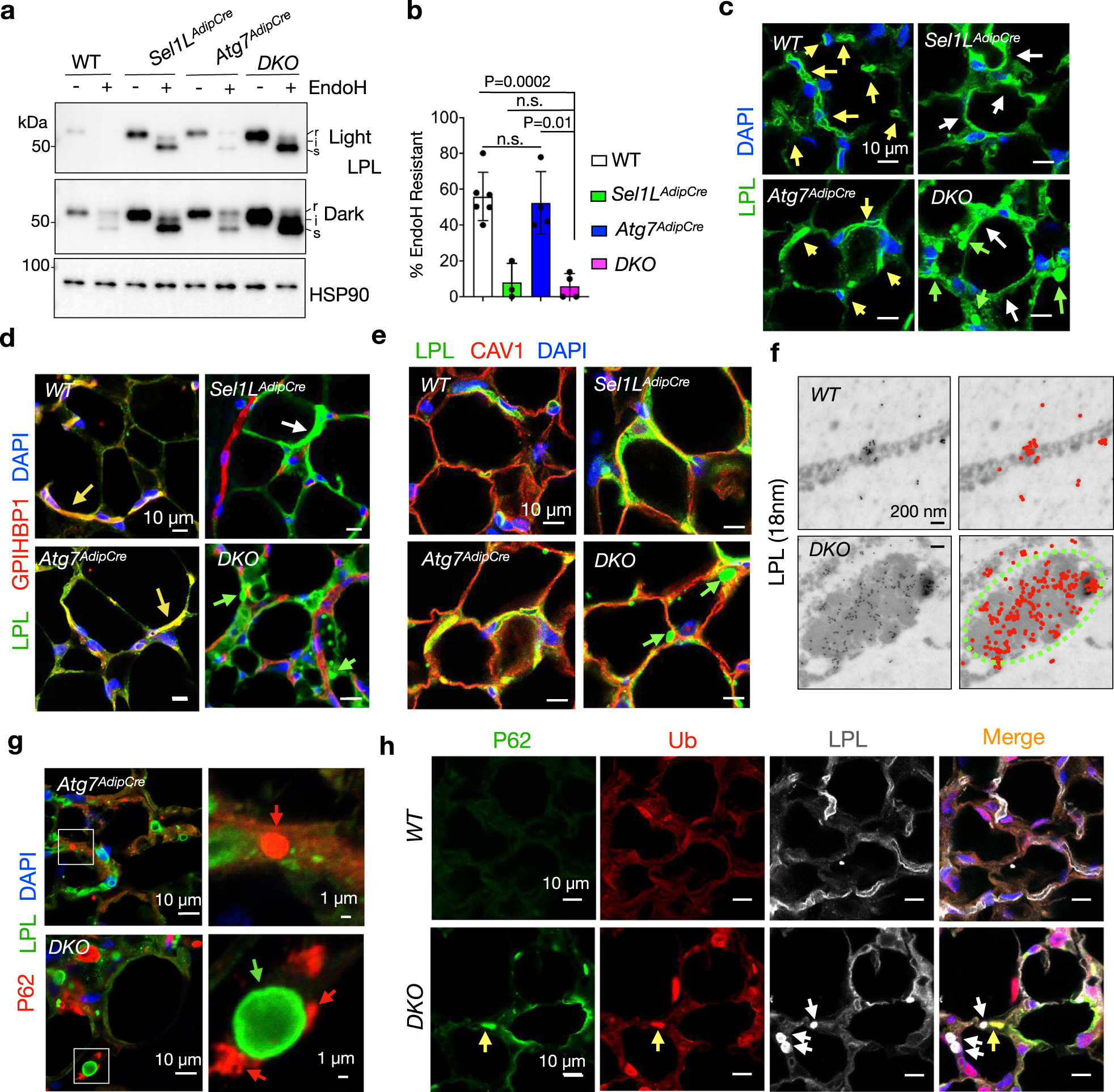 Fig. 4: LPL is a principal component of the CERFs.