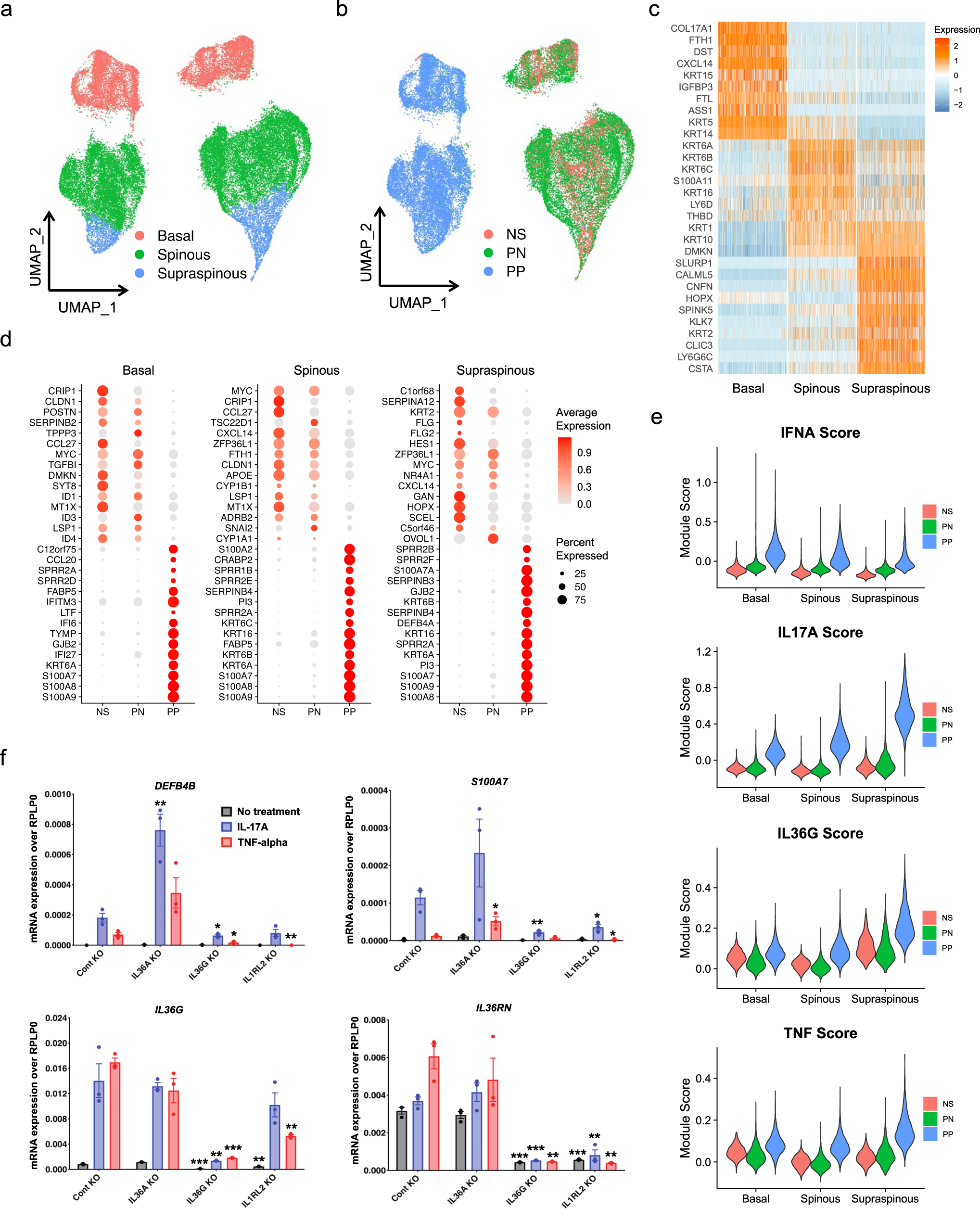 Fig. 2: IL-36 amplifies IL-17 response in the supraspinous epidermis of psoriatic skin.