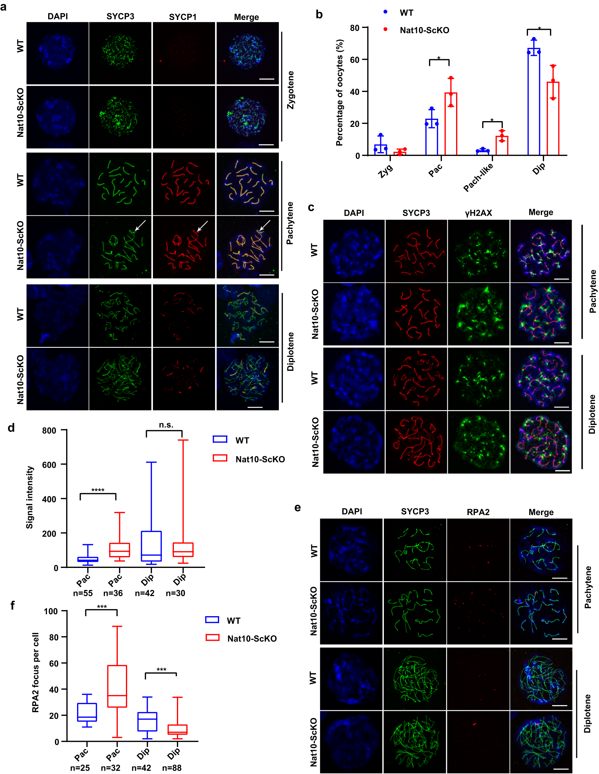 Fig. 3: Embryonic Nat10 loss caused oocyte meiotic prophase I arrest at pachytene stage owing to deficient DSB repair.