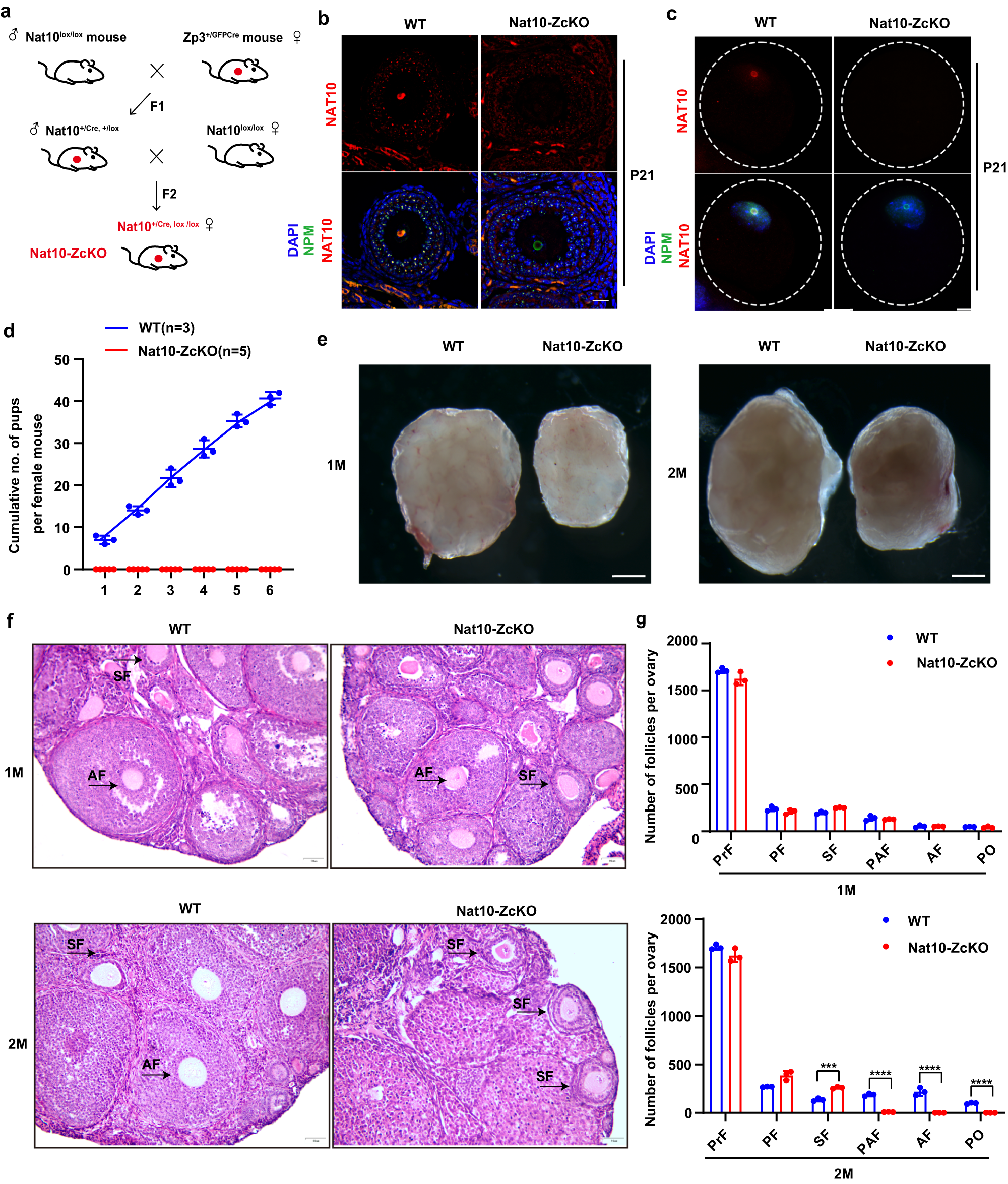 Fig. 4: Postnatal Nat10 depletion caused ovarian developmental arrest at secondary follicles.