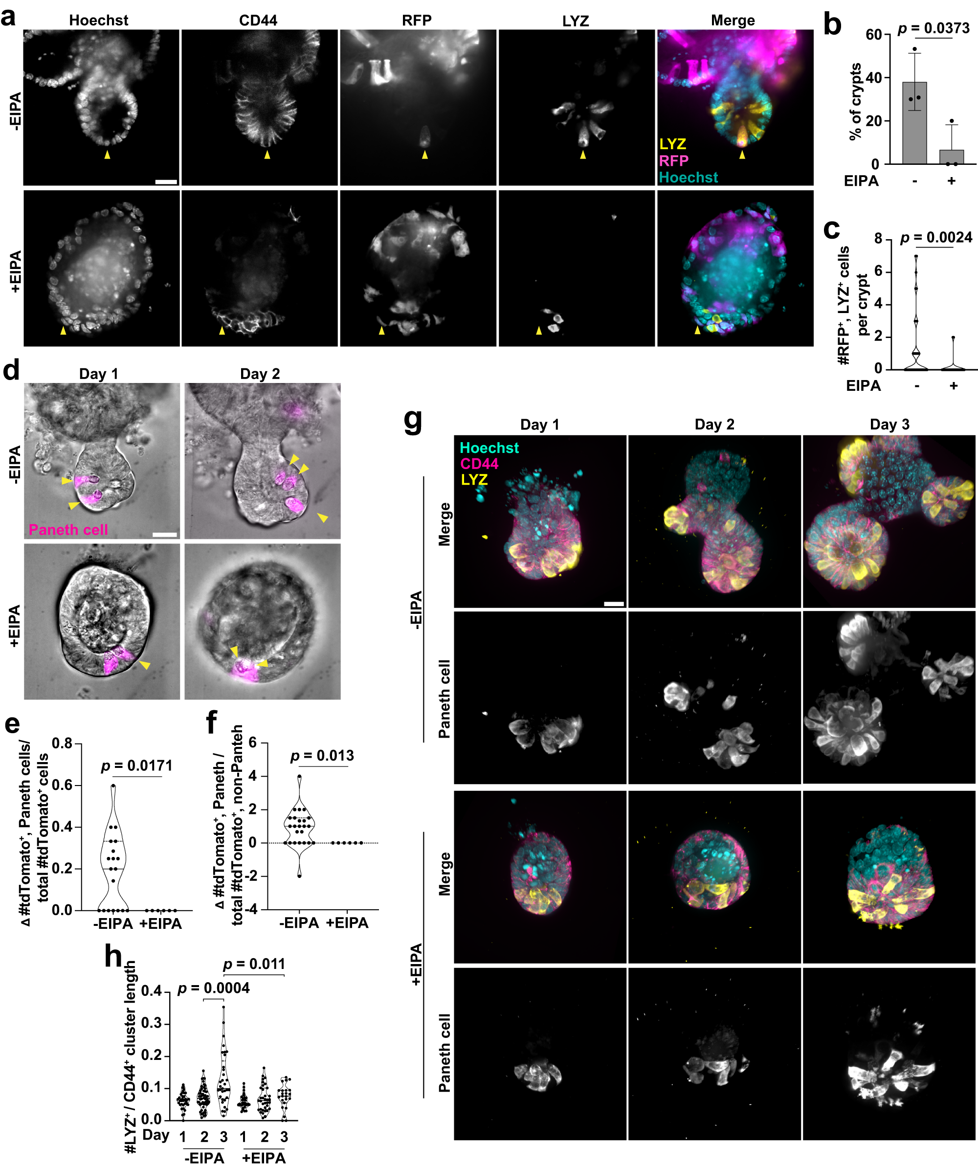 Fig. 8: Loss of NHE1 activity impaired Paneth cell differentiation.