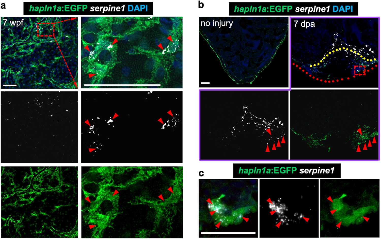 Fig. 6: hapln1a+ cells adjacent to coronary sprouts express the serpine1 gene.