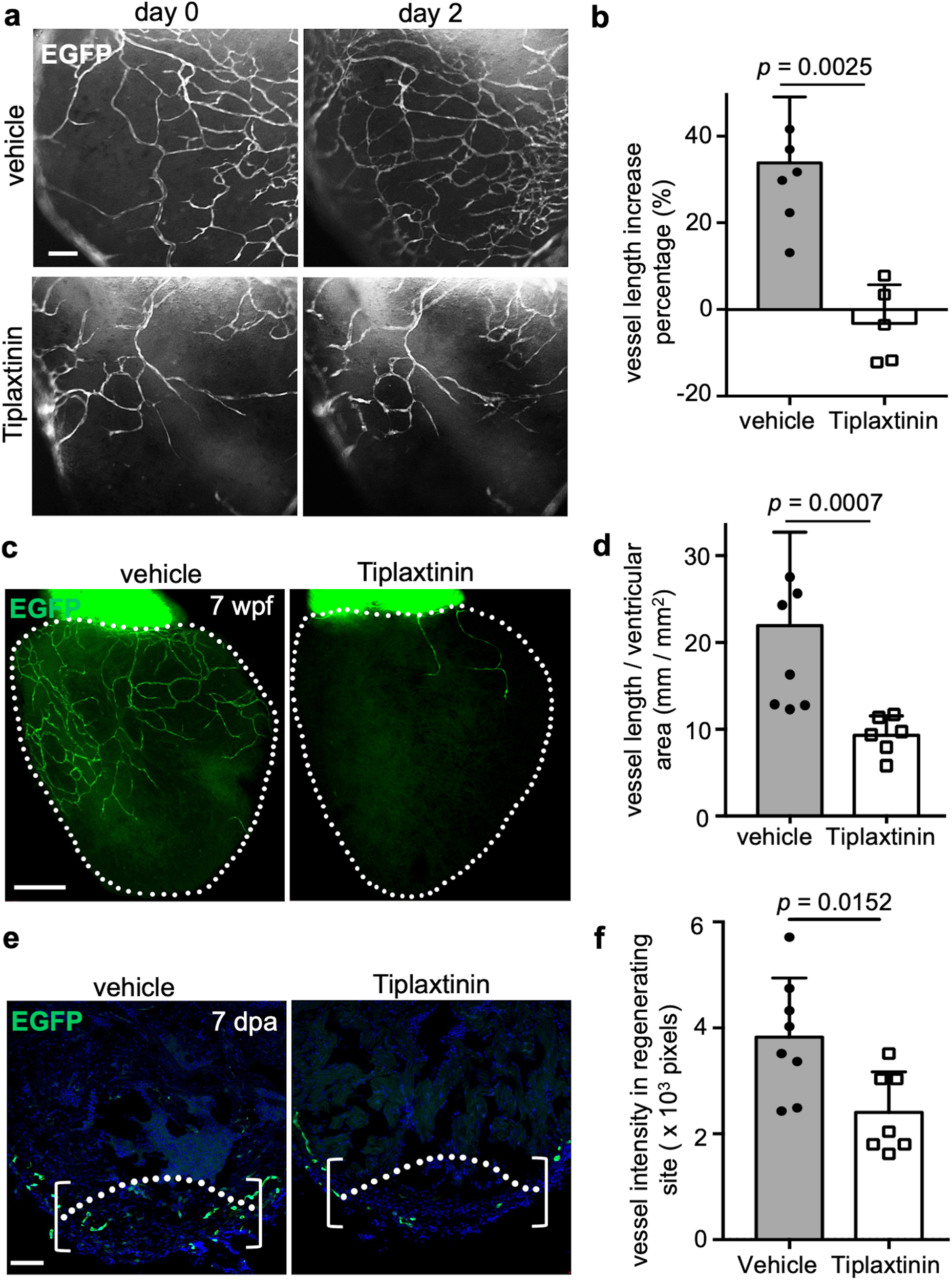Fig. 8: Inhibiting serpine1 function blocks coronary growth during vascularization and revascularization.