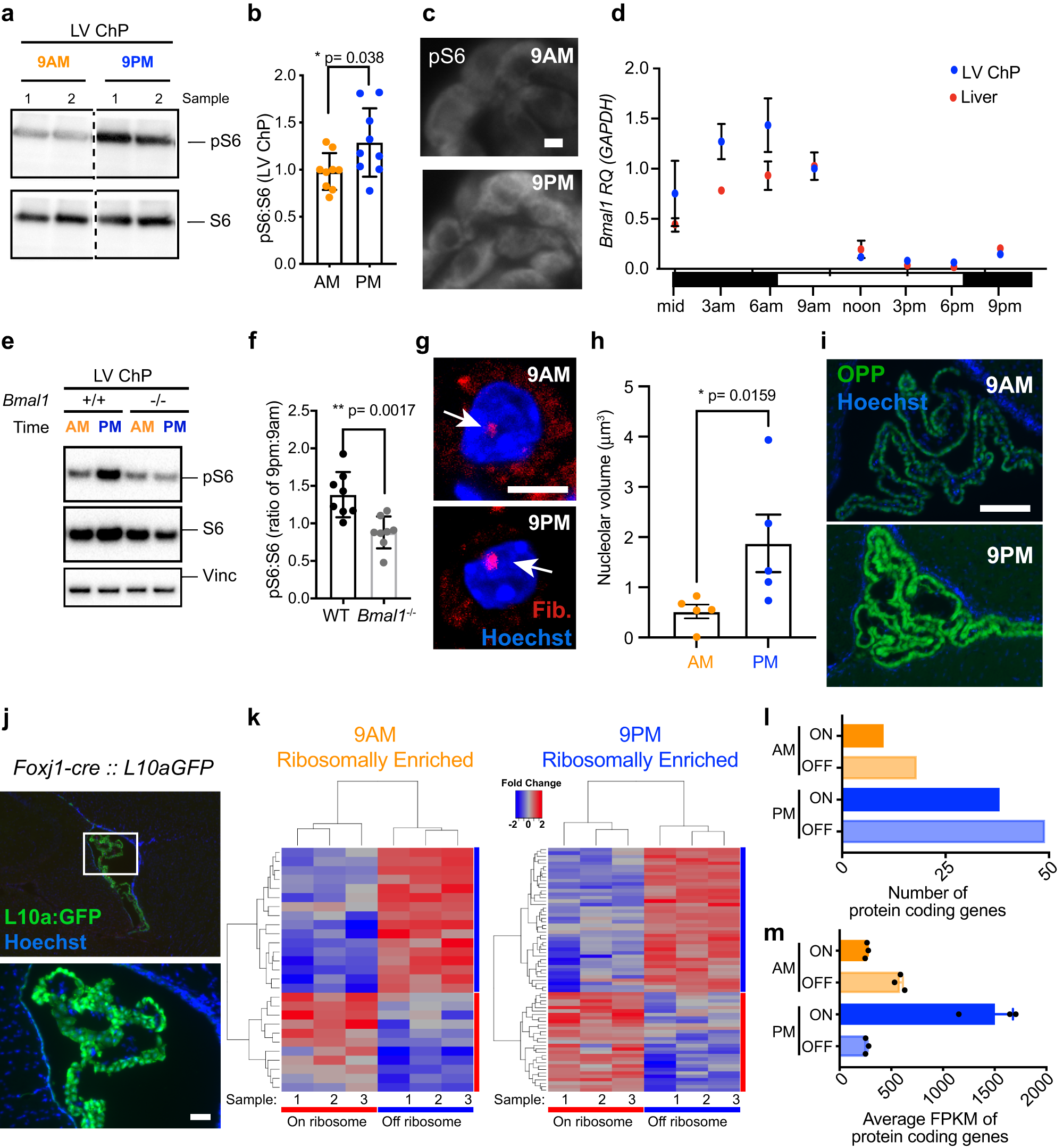 Defining diurnal fluctuations in mouse choroid plexus and CSF at high molecular, spatial, and temporal resolution Nature Communications