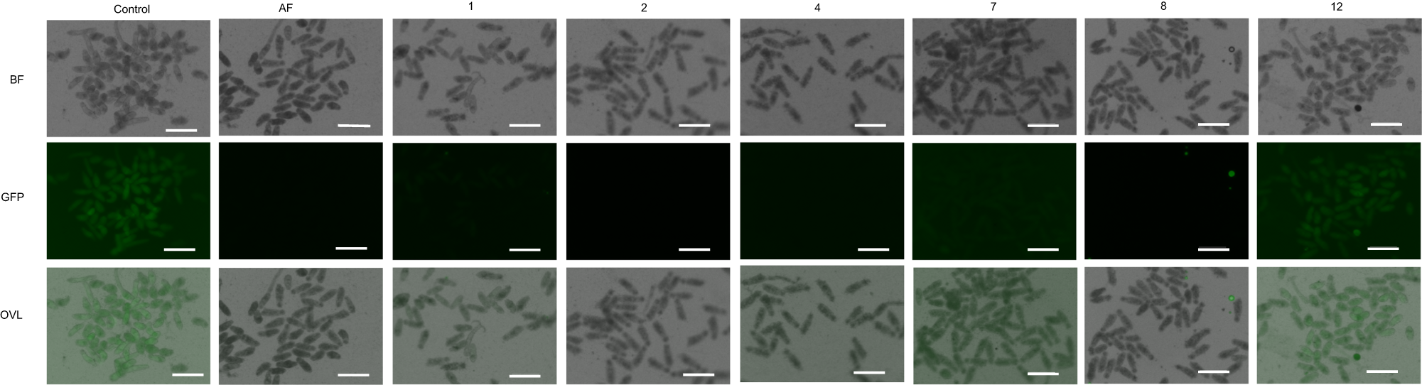 Fig. 2: Inhibition of TGR in newly transformed schistosomula (NTS) visualized with TRFS-Green.