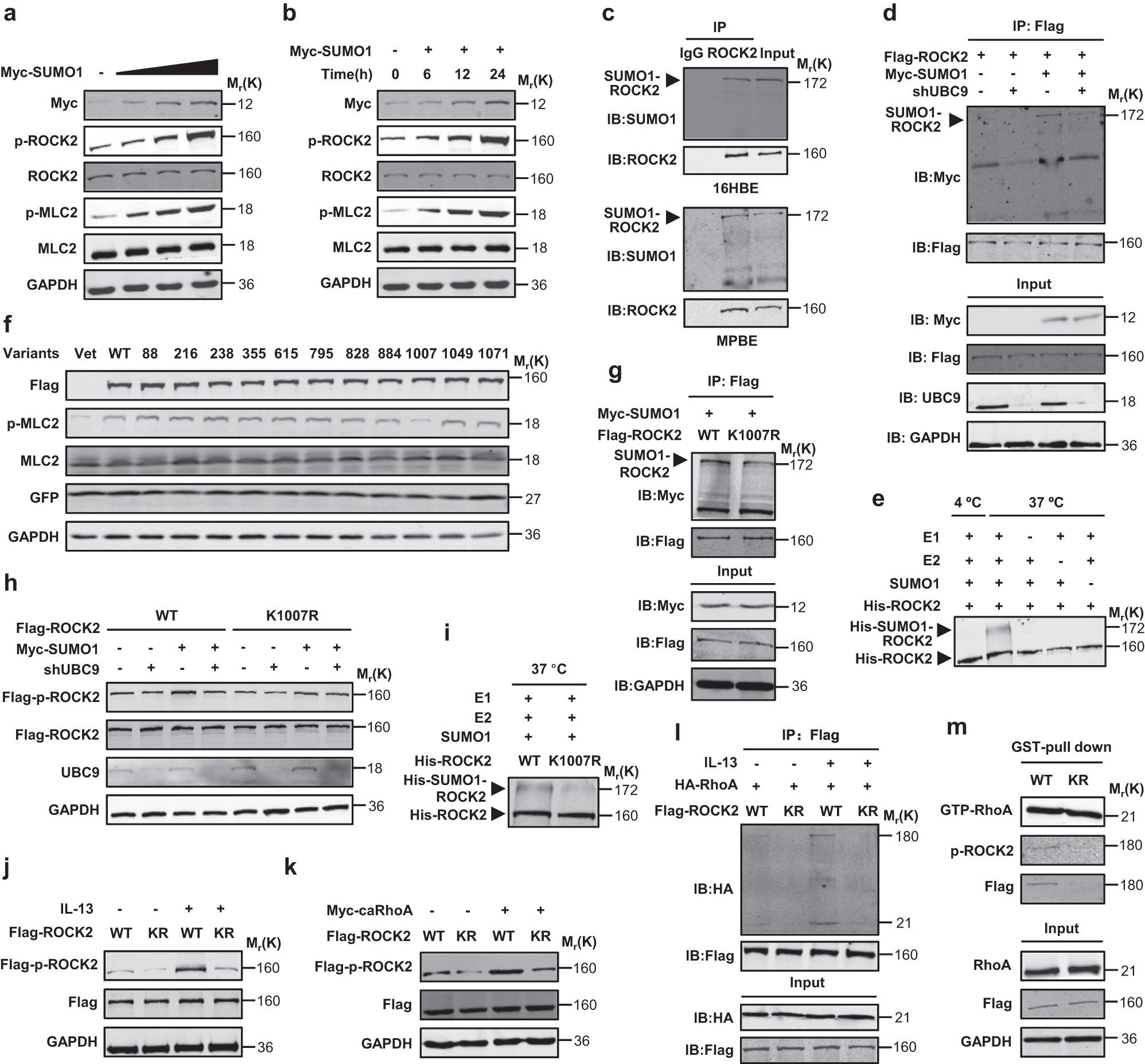 Fig. 5: ROCK2 is SUMOylated on K1007 to be activated.