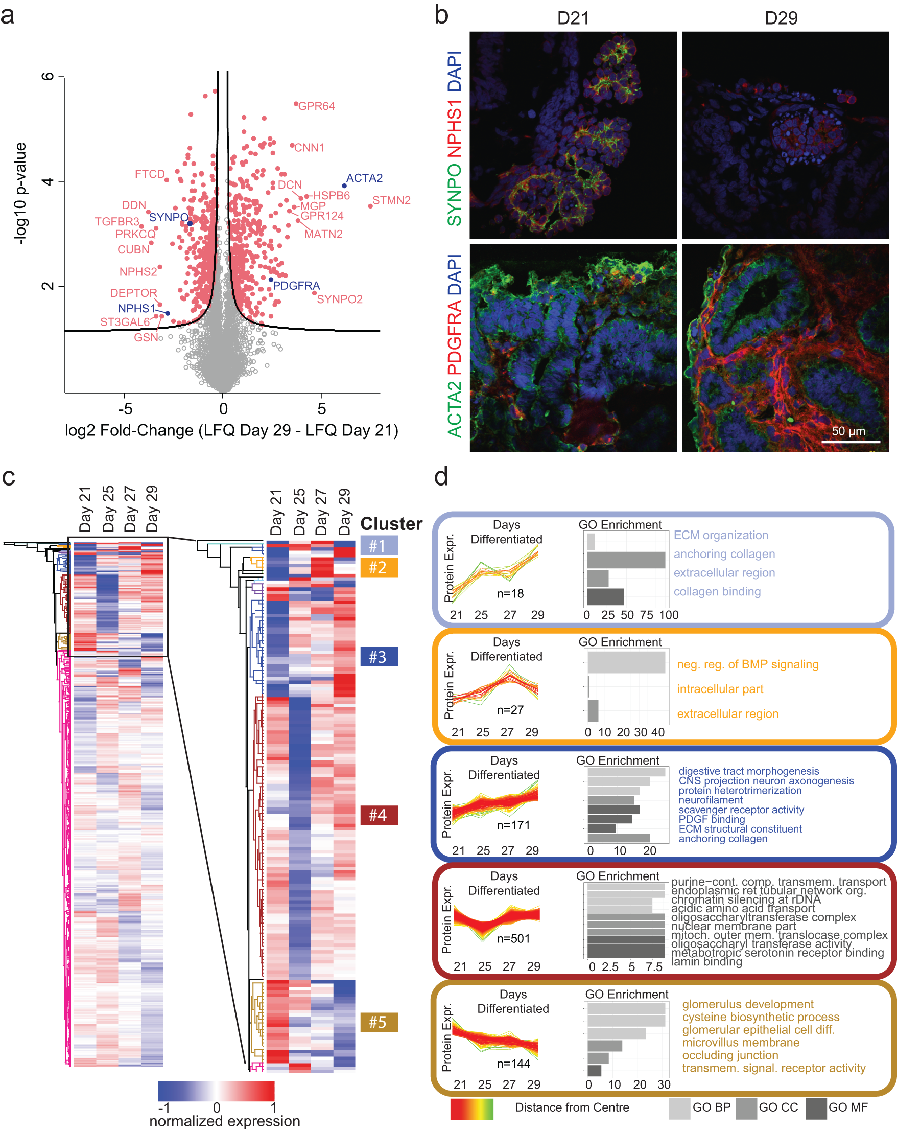 Beads on a String - Renal Fellow Network