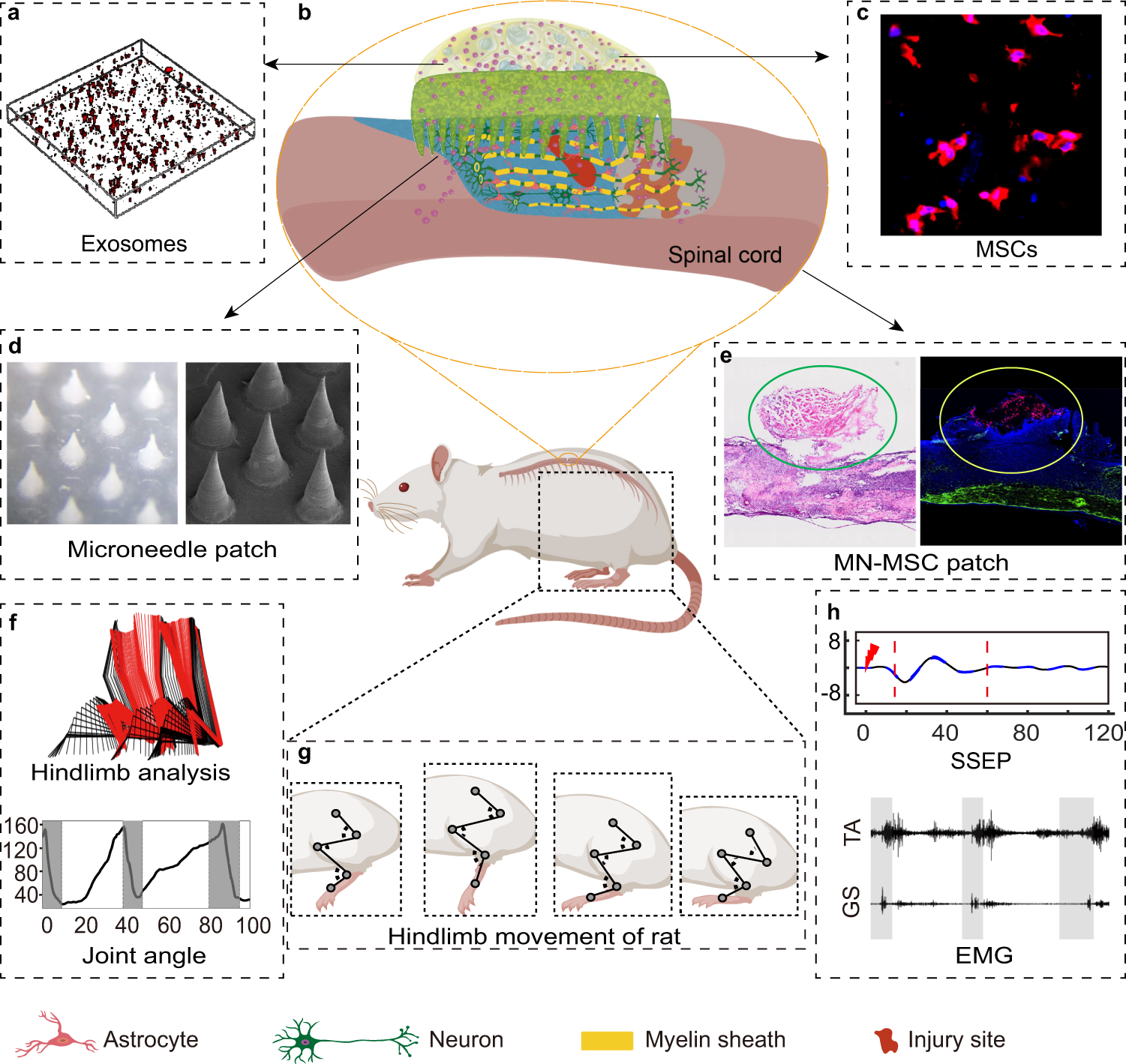 Porous microneedle patch with sustained delivery of extracellular vesicles  mitigates severe spinal cord injury